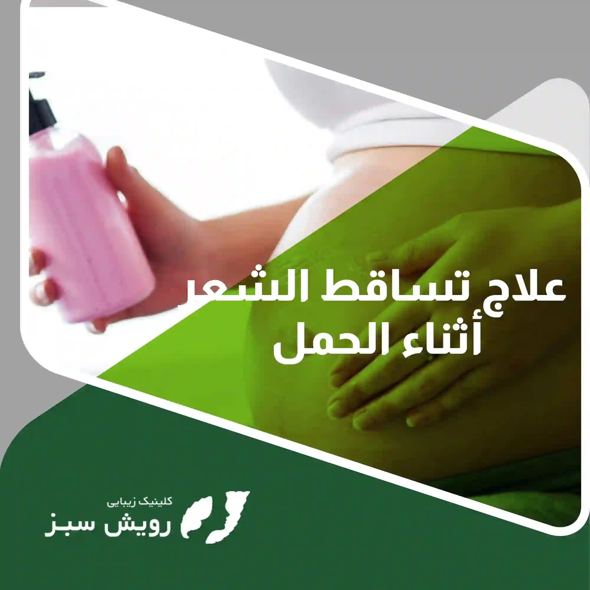 You are currently viewing علاج تساقط الشعر أثناء الحمل