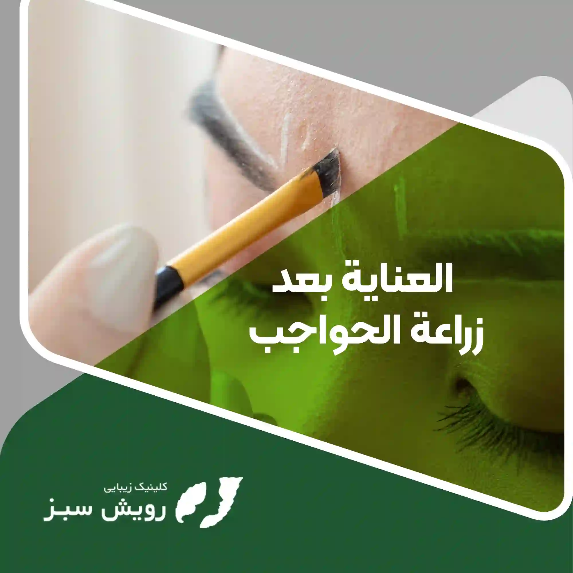 You are currently viewing العناية بعد زراعة الحواجب: دليلك الشامل للحصول على نتائج مثالية