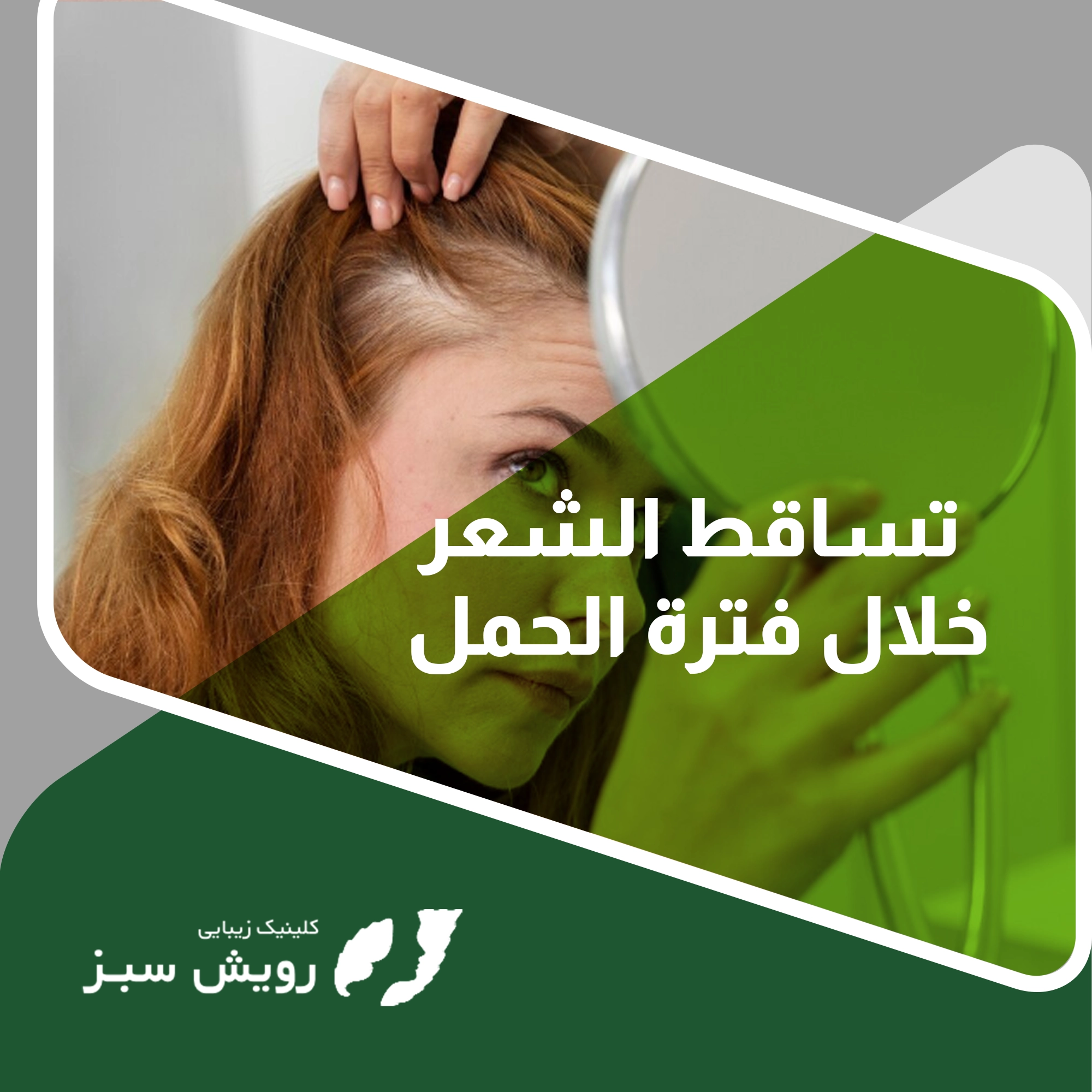 You are currently viewing ما هو سبب تساقط الشعر خلال فترة الحمل؟