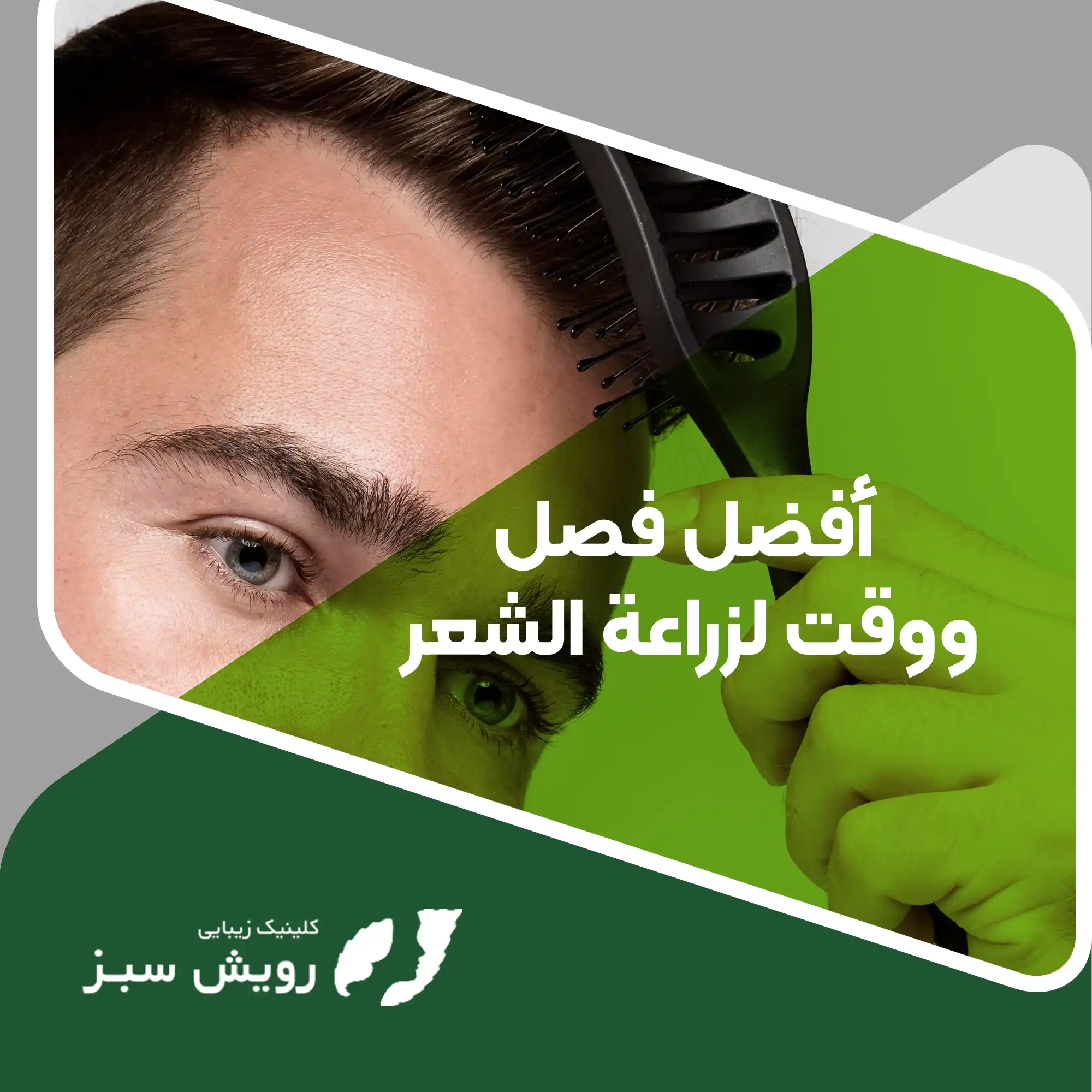 You are currently viewing أفضل فصل ووقت لزراعة الشعر