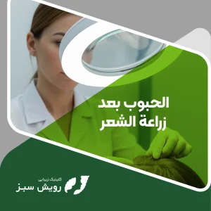 Read more about the article الحبوب بعد زراعة الشعر: الأسباب العلاج وكيفية الوقاية منها للحفاظ على نتيجة مثالية