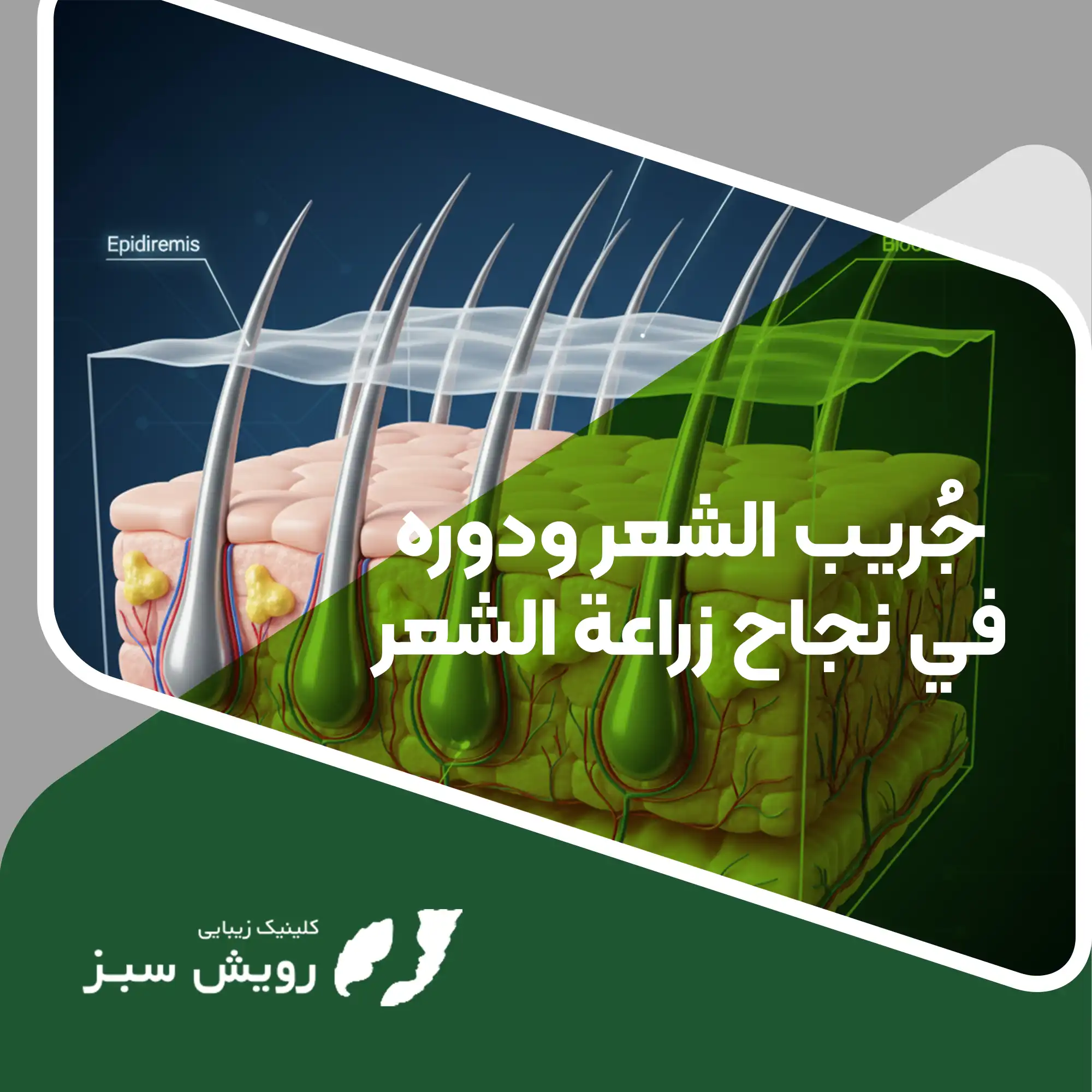 You are currently viewing ما هو جُريب الشعر ولماذا يُعَدّ أساس نجاح عملية زراعة الشعر؟