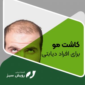 Read more about the article کاشت مو برای افراد دیابتی