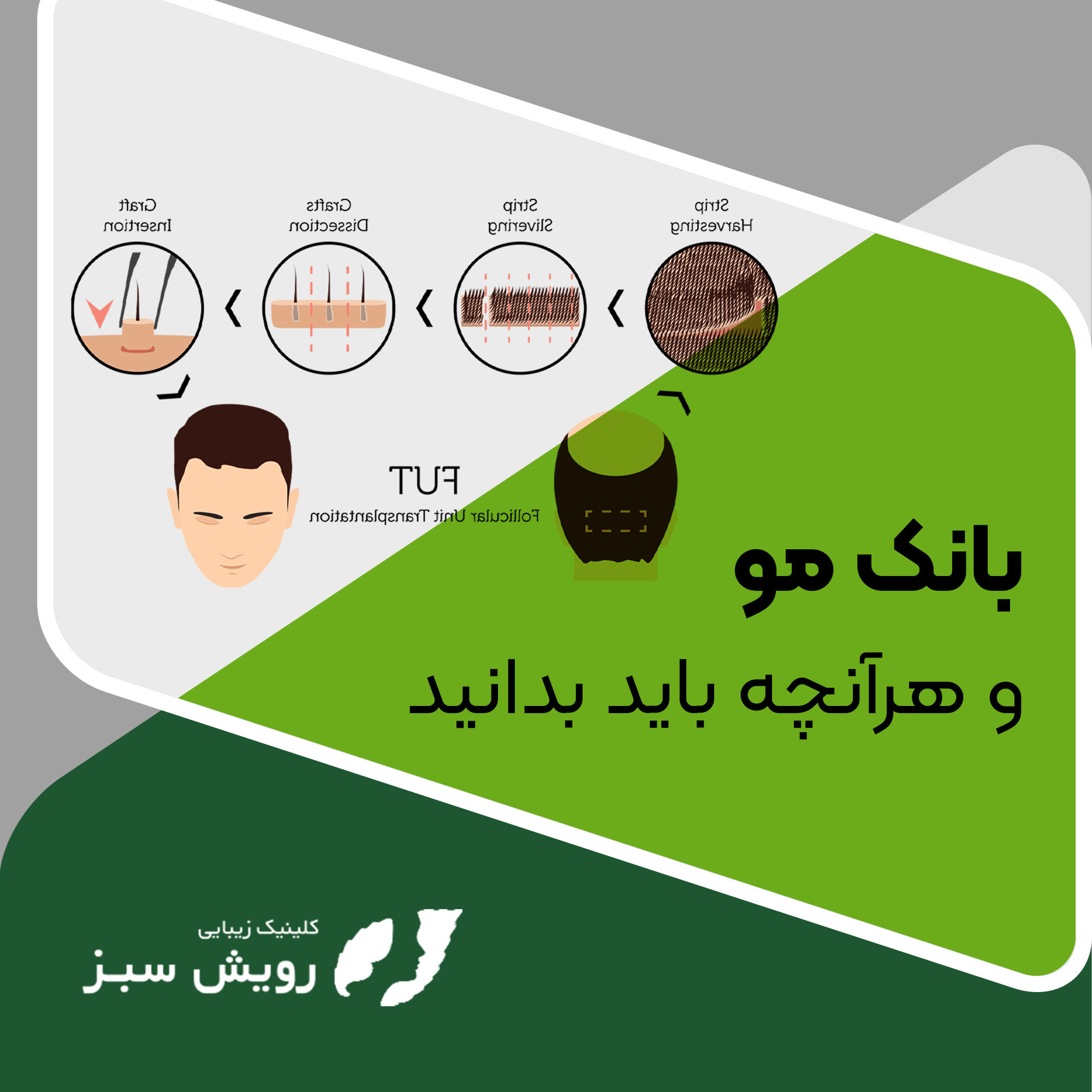 You are currently viewing بانک مو چیست ؟