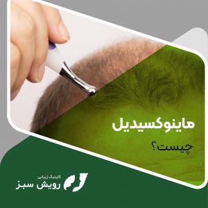 Read more about the article ماینوکسیدیل چیست؟