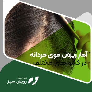 Read more about the article آمار ریزش موی مردان در کشورهای مختلف