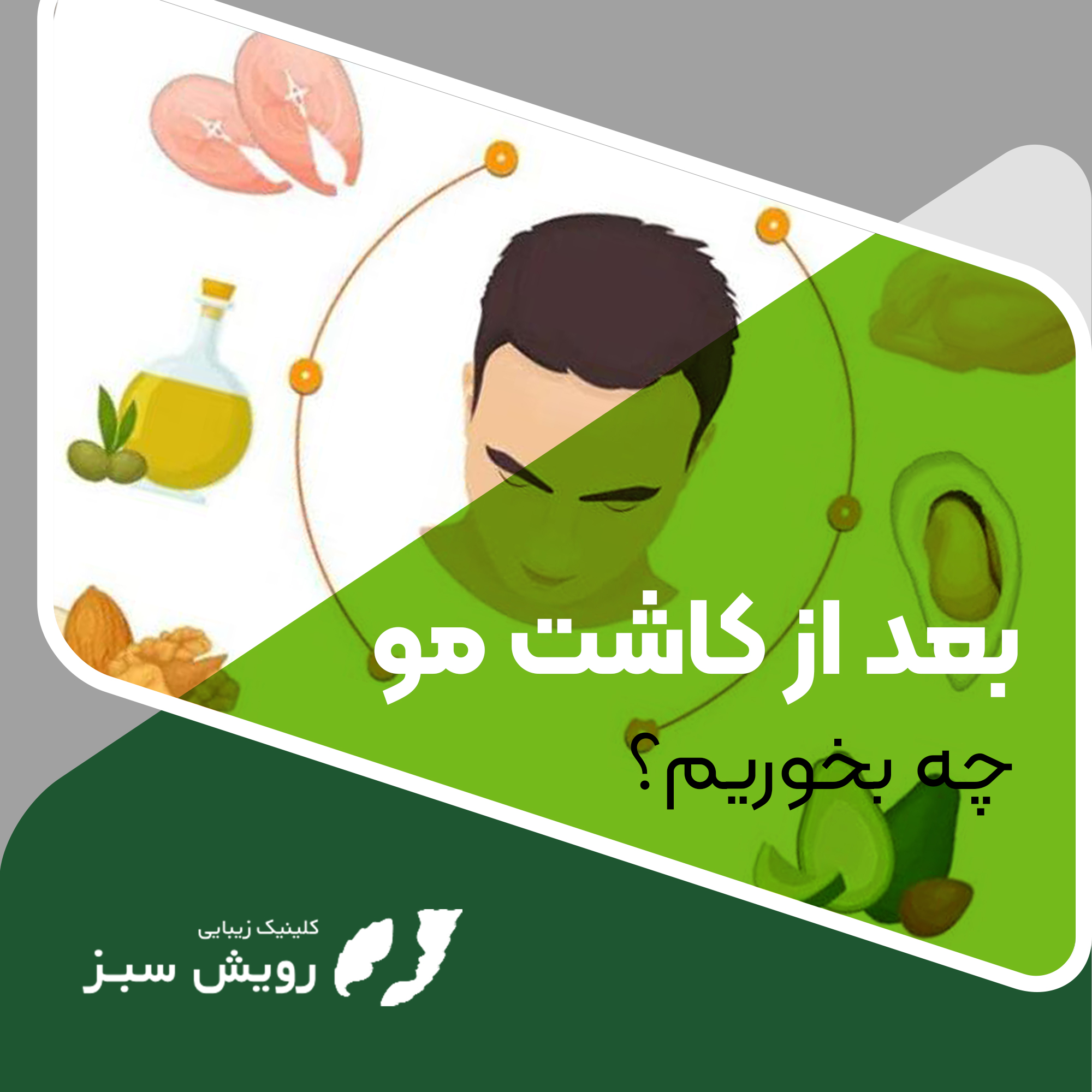 You are currently viewing بعد از کاشت مو چه بخوریم؟