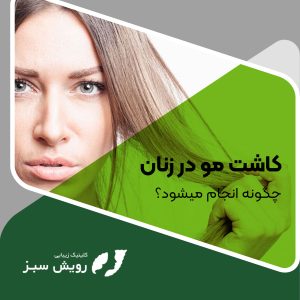 Read more about the article کاشت مو در زنان چگونه انجام میشود؟