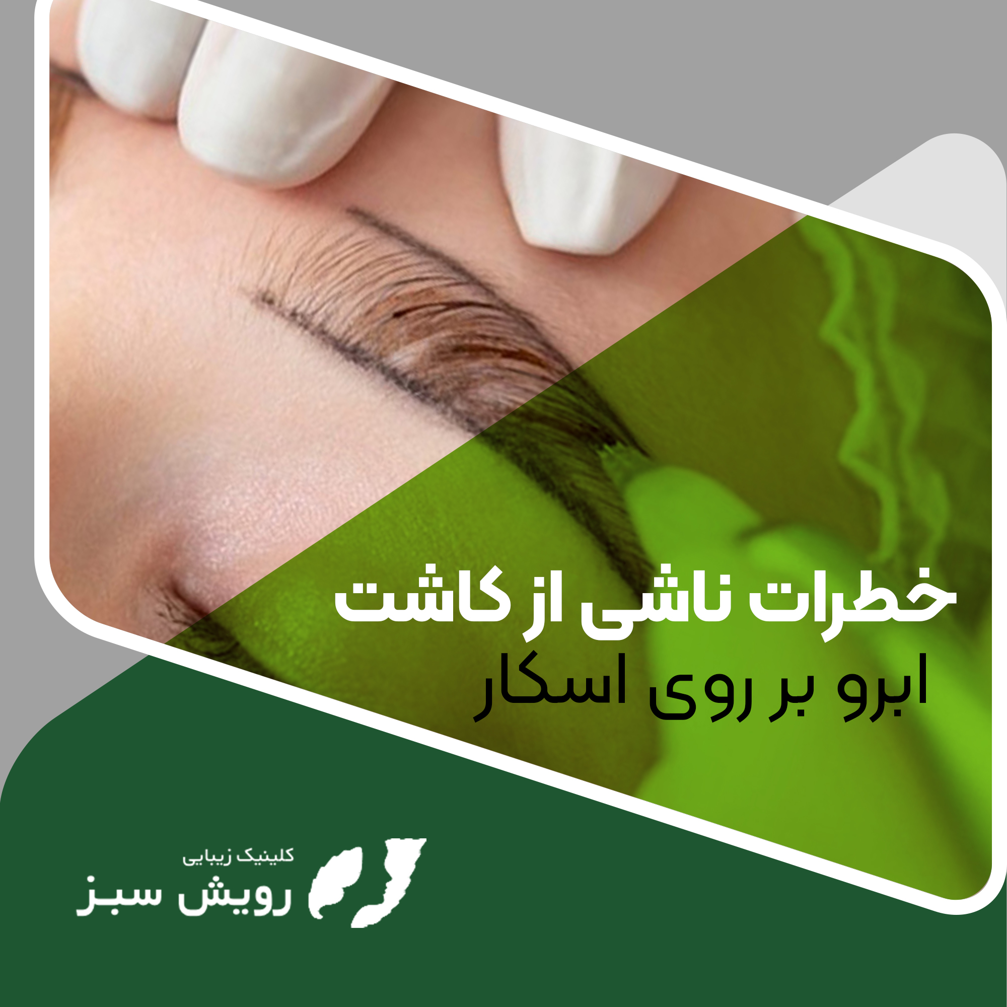 You are currently viewing خطرات ناشی از کاشت ابرو بر روی اسکار
