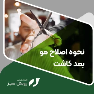 Read more about the article نحوه اصلاح مو بعد کاشت