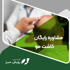 Read more about the article مشاوره رایگان کاشت مو