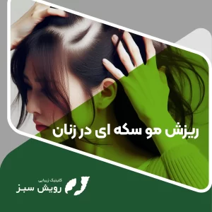 Read more about the article ریزش مو سکه ای در زنان چیست و راهکار جلوگیری و درمان آن چیست؟