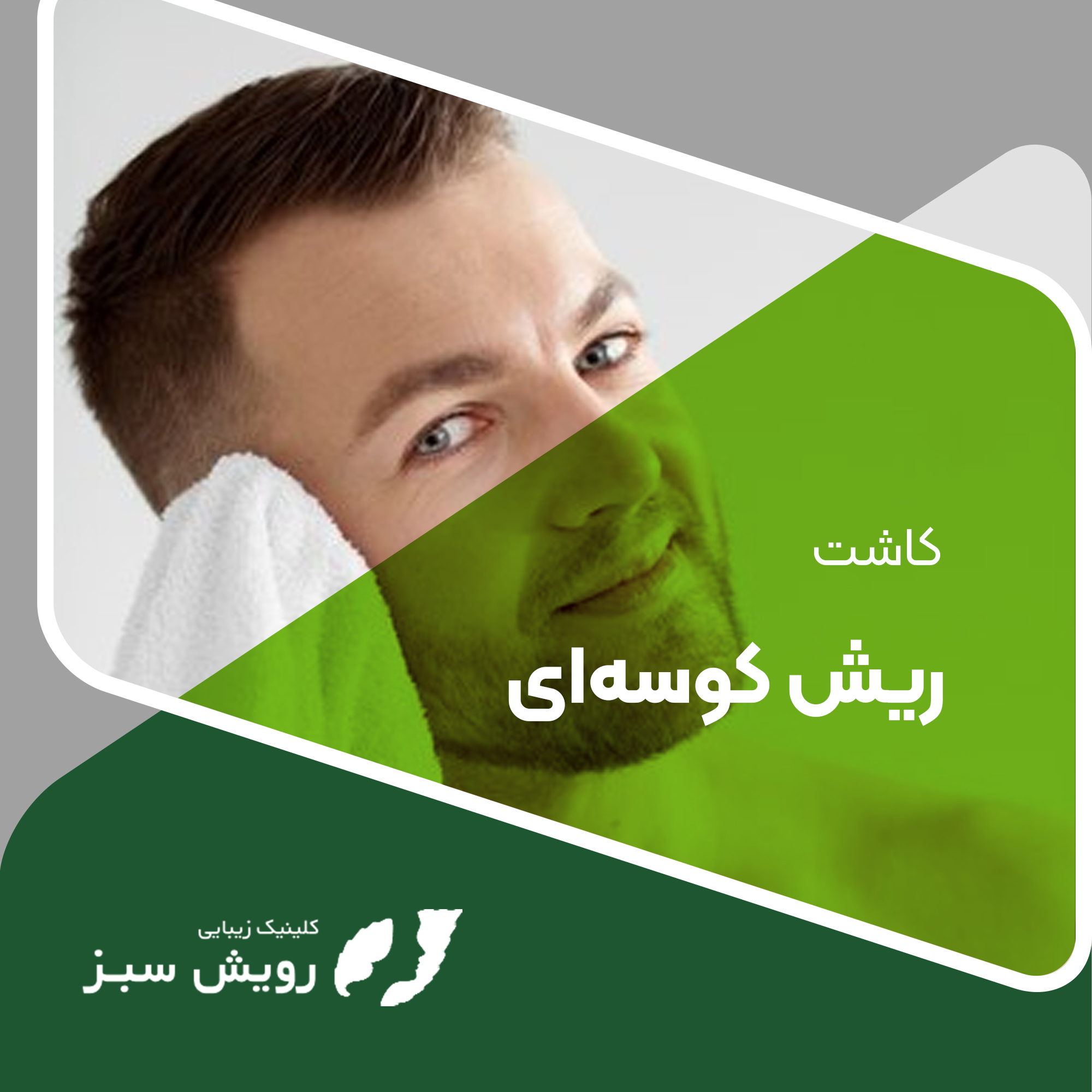 You are currently viewing کاشت ریش کوسه‌ای