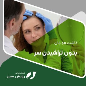 Read more about the article کاشت مو زنان بدون تراشیدن سر