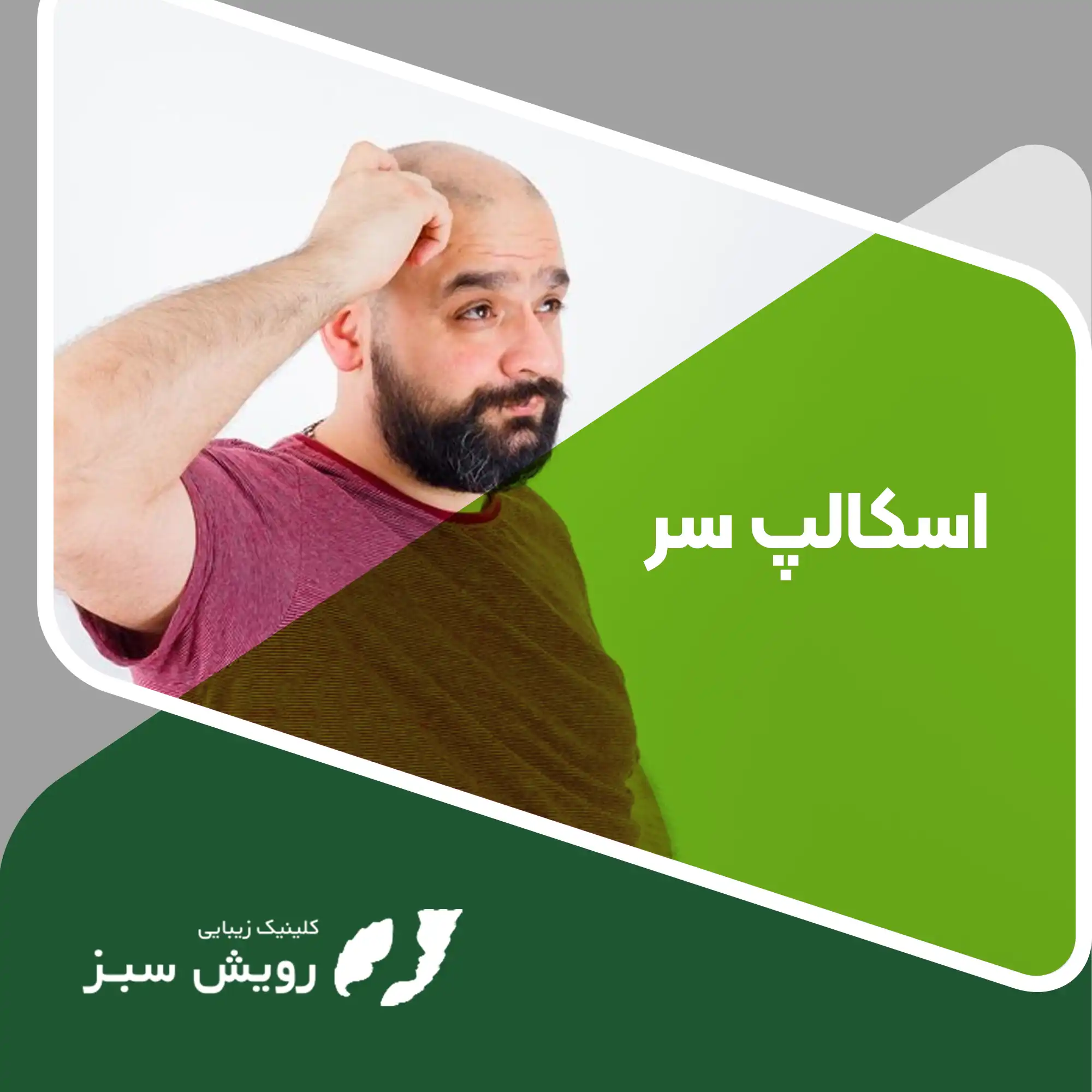 You are currently viewing اسکالپ سر –  راهی نوین برای بهبود ظاهر و اعتماد به نفس