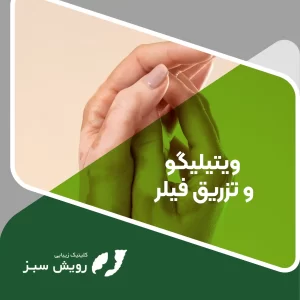 Read more about the article ویتیلیگو و تزریق فیلر: راهی نوین برای بهبود ظاهر پوست