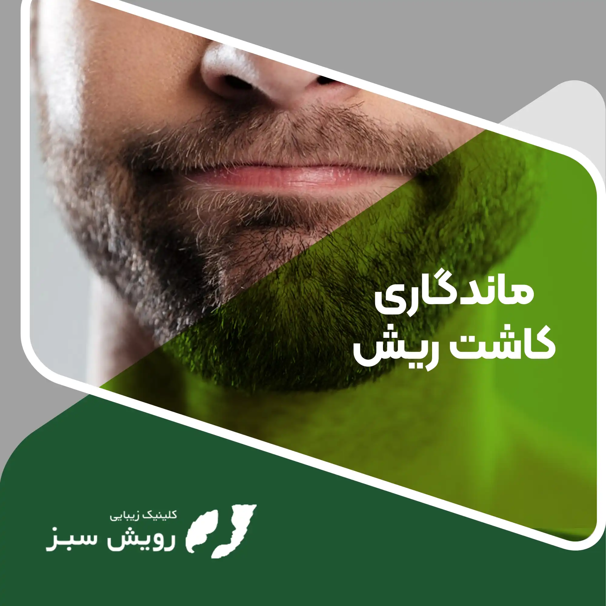 You are currently viewing ماندگاری کاشت ریش چقدر است و به چه فاکتورهایی بستگی دارد؟