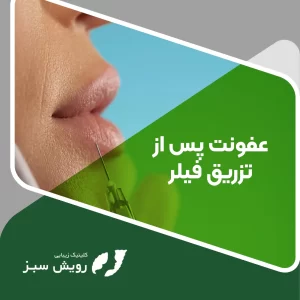 Read more about the article نشانه‌های عفونت لب بعد از تزریق ژل و نحوه‌ی تشخیص آن