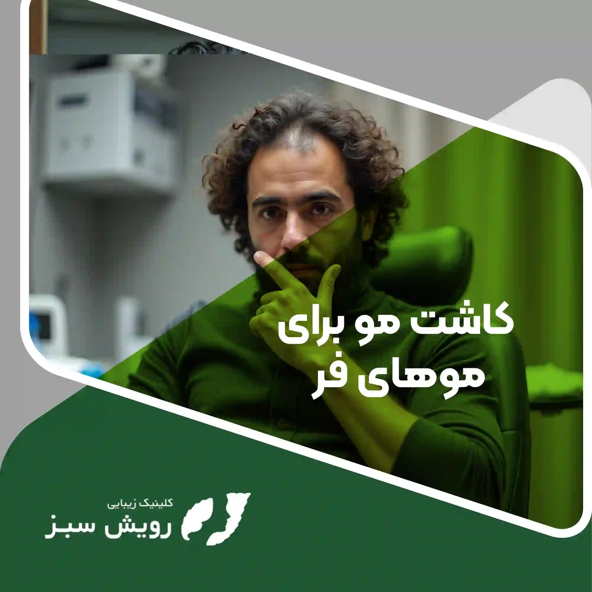 Read more about the article آیا افراد با موهای فر می‌توانند کاشت مو انجام دهند؟