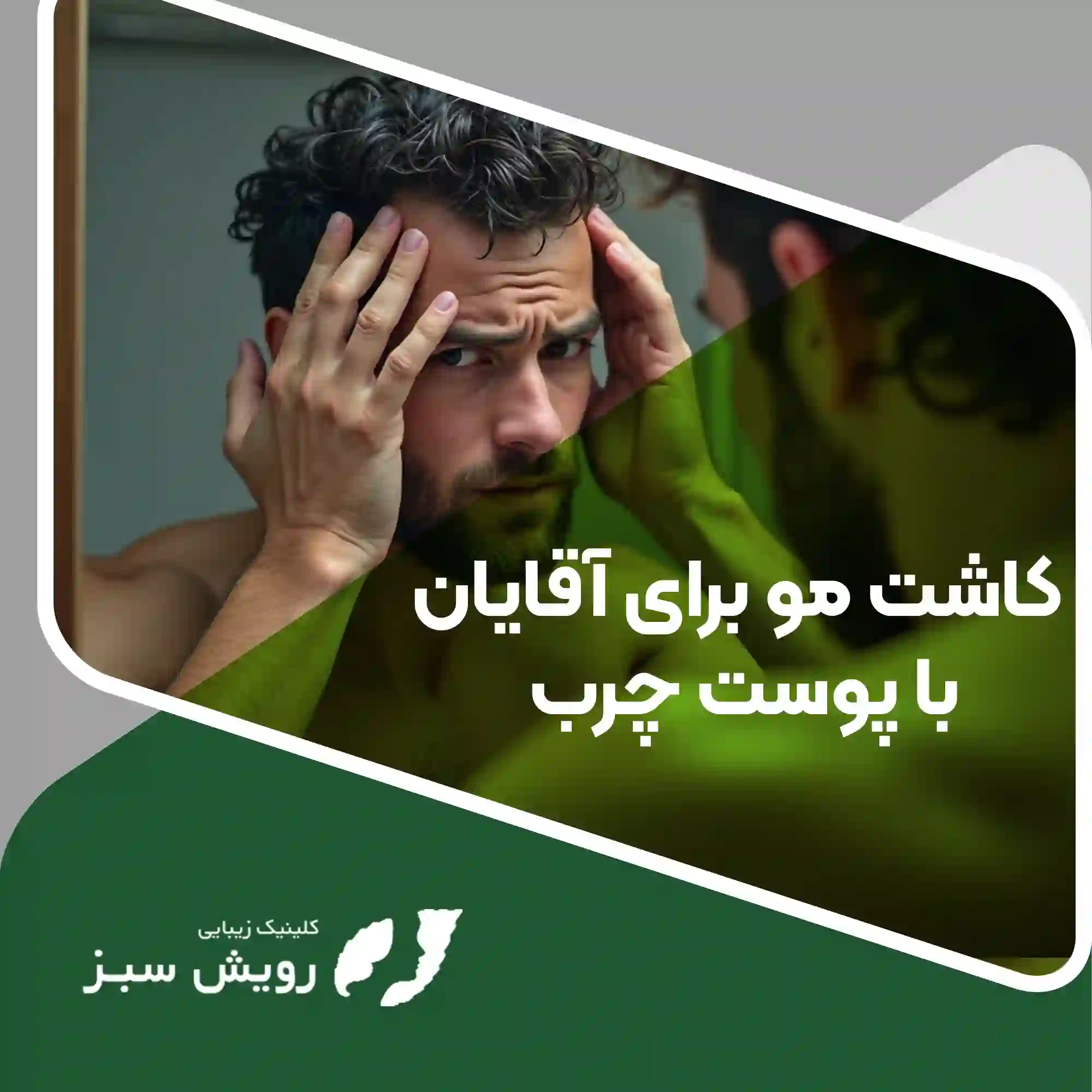 Read more about the article کاشت مو برای آقایان با پوست چرب: چالش‌ها و مشخصه‌ها