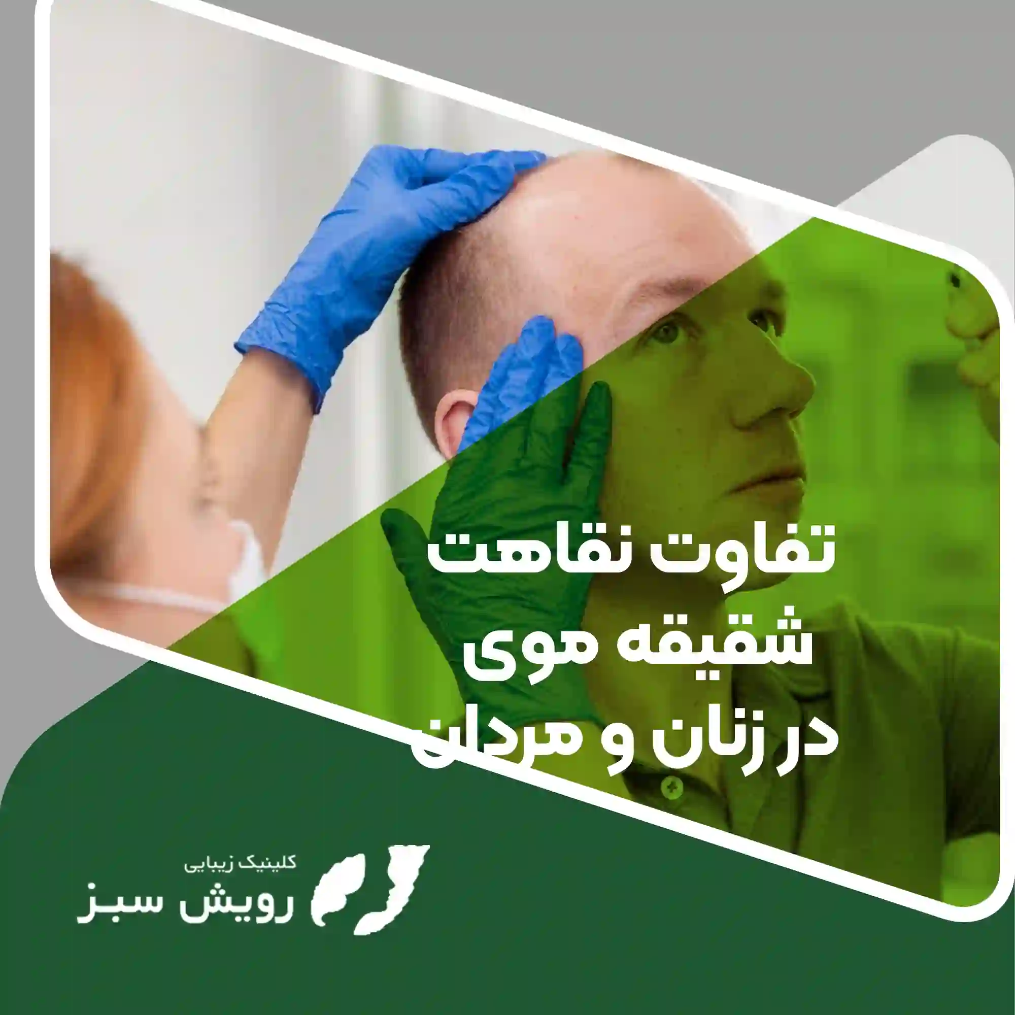 Read more about the article نقاهت کاشت موی شقیقه در مردان و زنان؛ تفاوت‌ها و نکات مهمی که باید بدانید