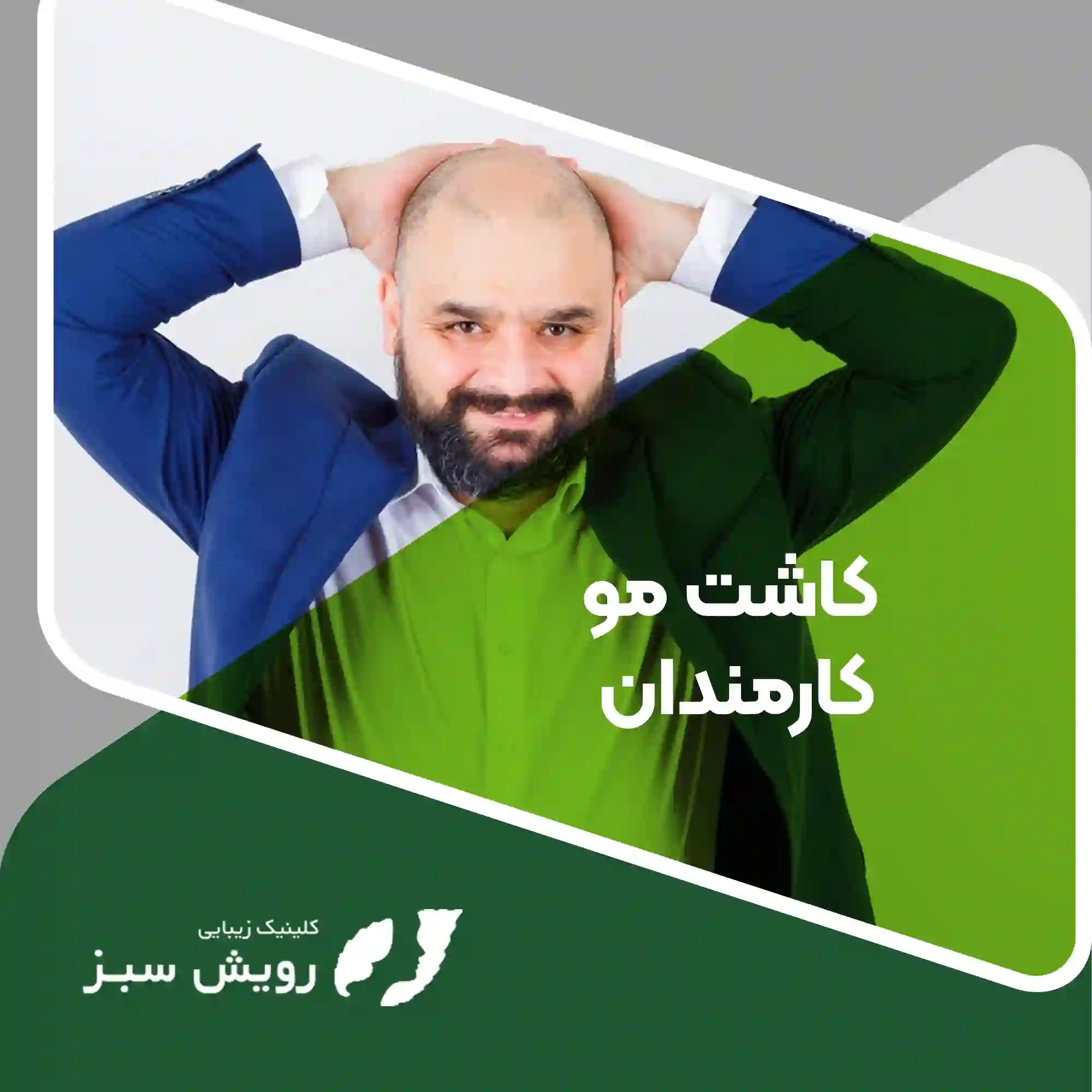 Read more about the article تجربه کاشت مو برای کارمندان اداری با استرس بالا چطور است؟