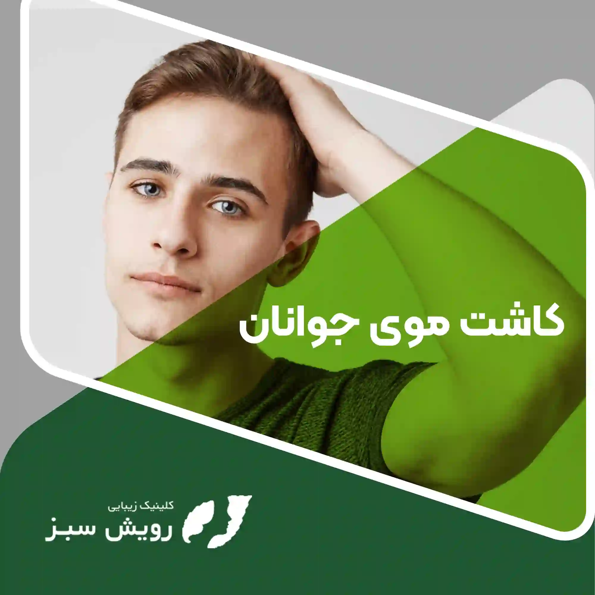 Read more about the article بهترین روش کاشت مو برای جوانان چیست؟