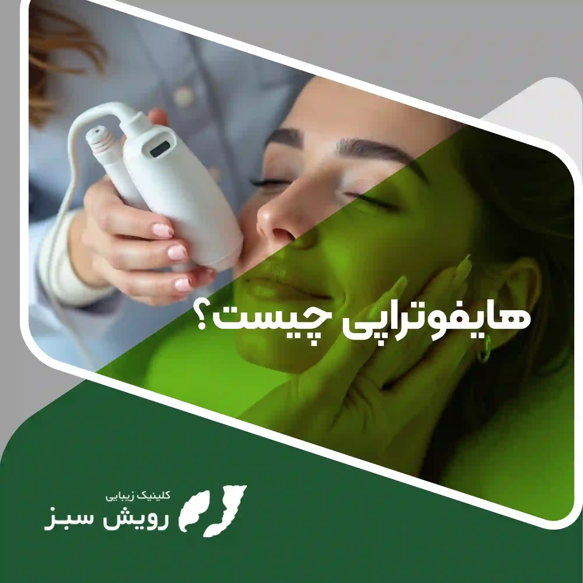 Read more about the article هایفوتراپی – راهکاری نوین برای جوانسازی پوست و رفع افتادگی صورت