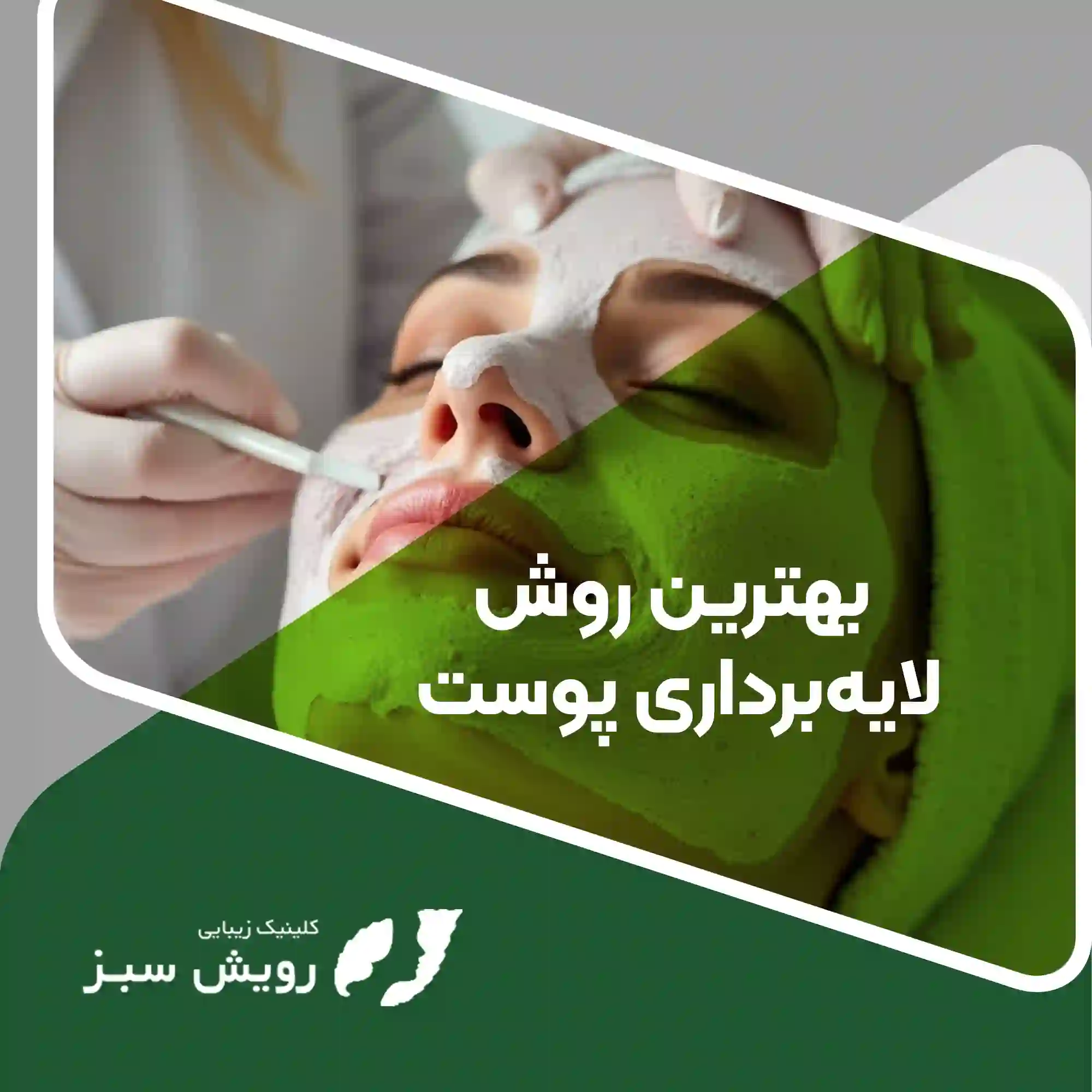 Read more about the article لایه برداری پوست  – راهنمای کامل برای داشتن پوستی شفاف و جوان