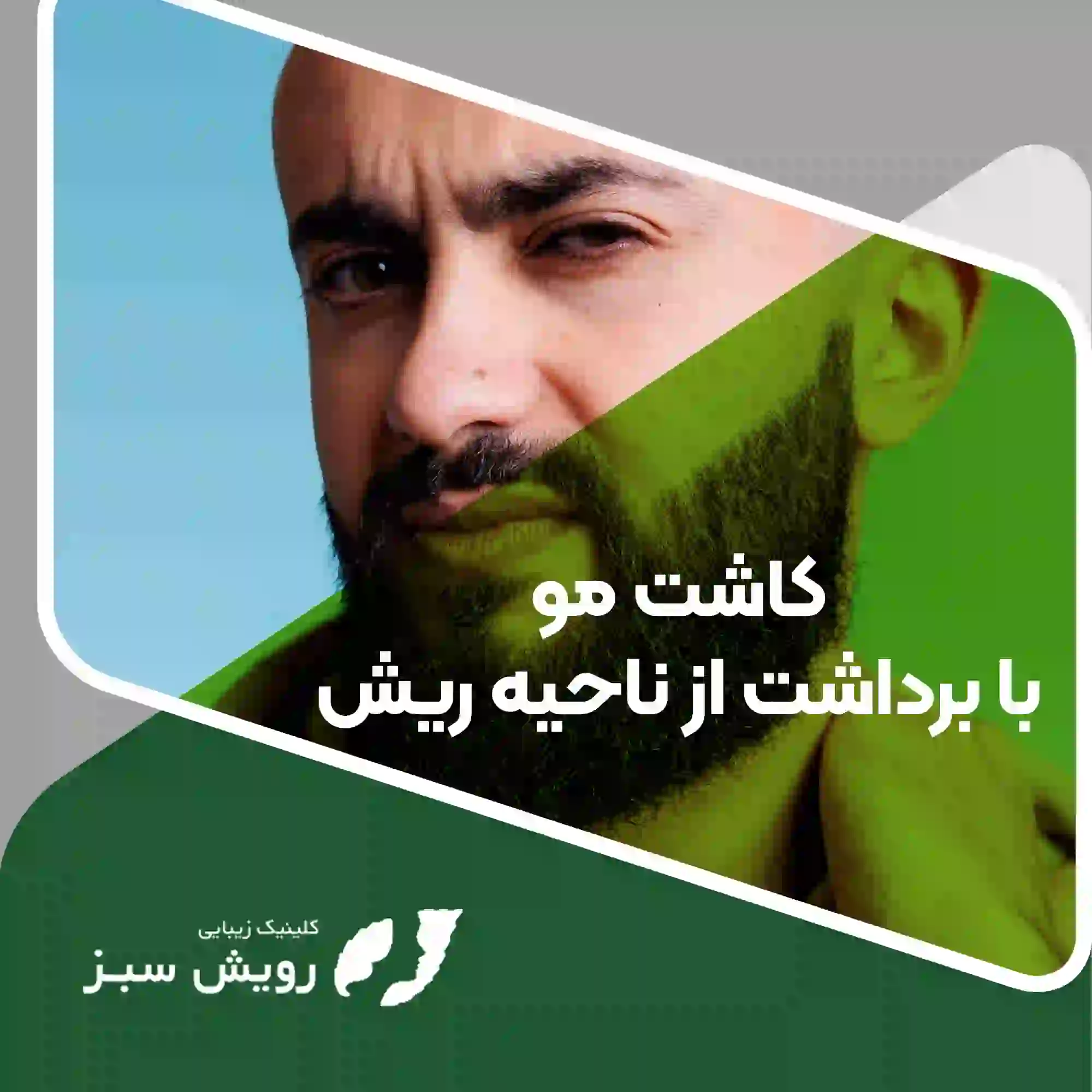 Read more about the article آنچه باید در مورد استفاده از ریش برای بانک مو بدانید
