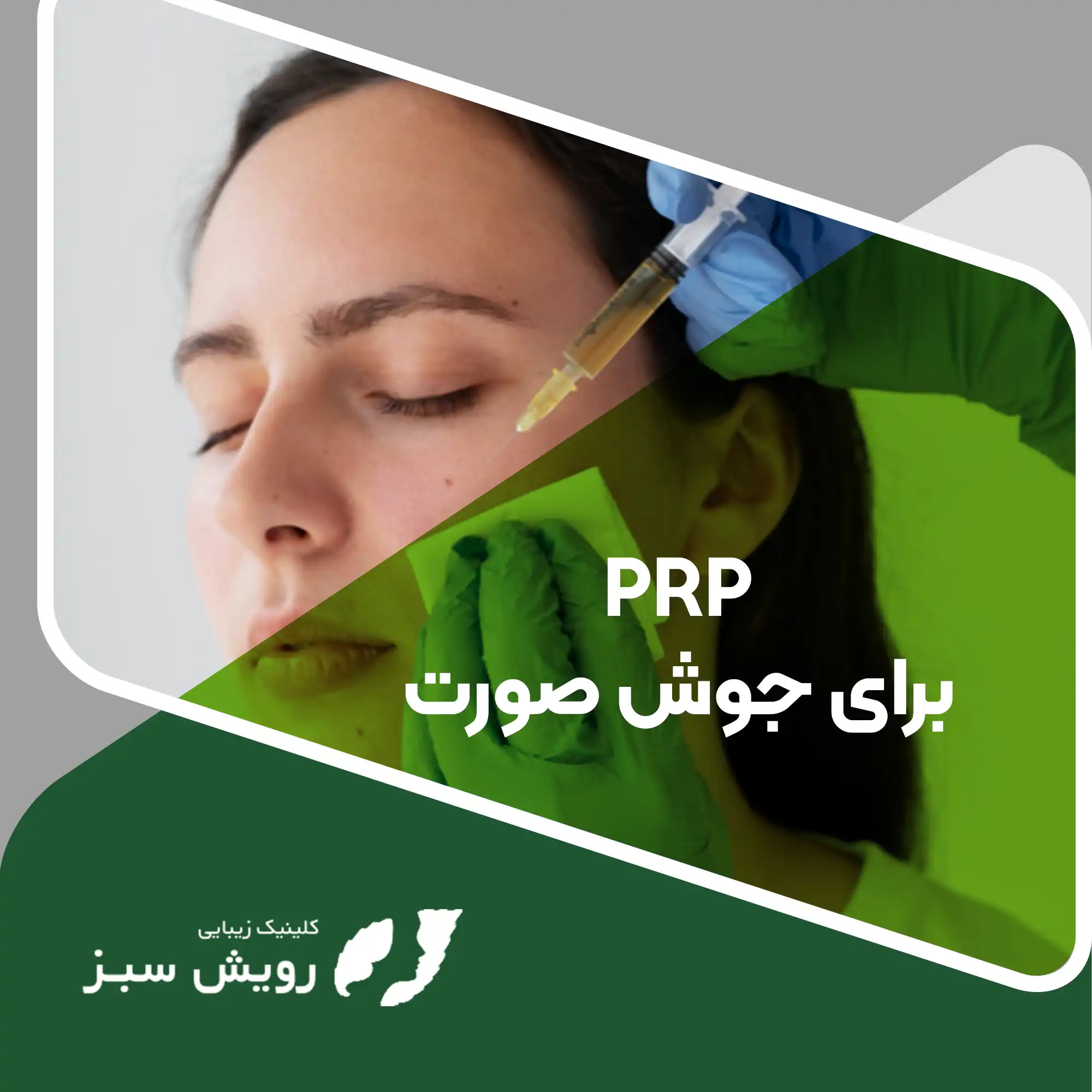 Read more about the article PRP برای درمان جوش‌های صورت چگونه می‌تواند مشکل آکنه پوستی شما را برای همیشه حل کند؟