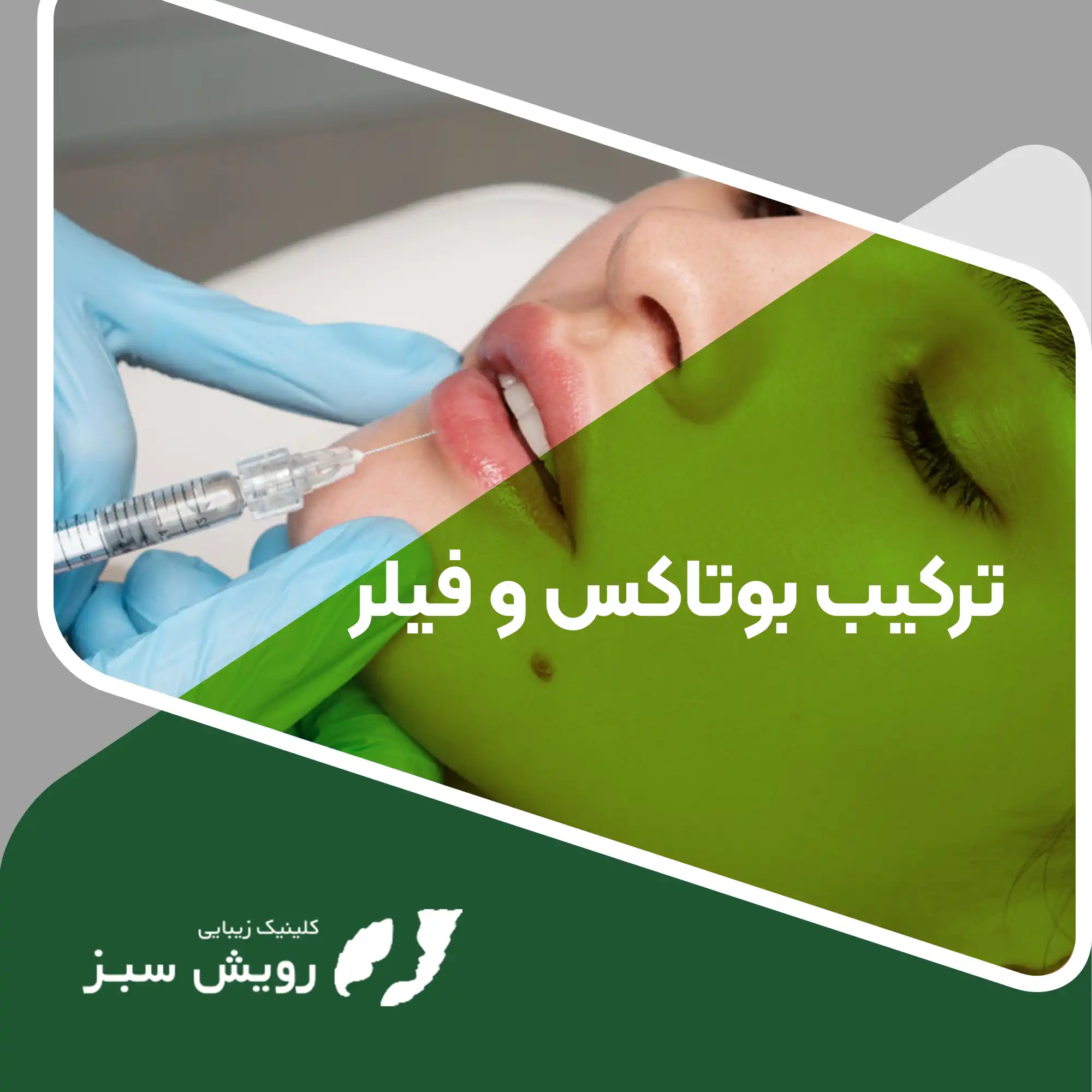 Read more about the article ترکیب بوتاکس و فیلر چگونه جوانسازی صورت را با نتایج طبیعی و ماندگار ممکن می‌سازد؟