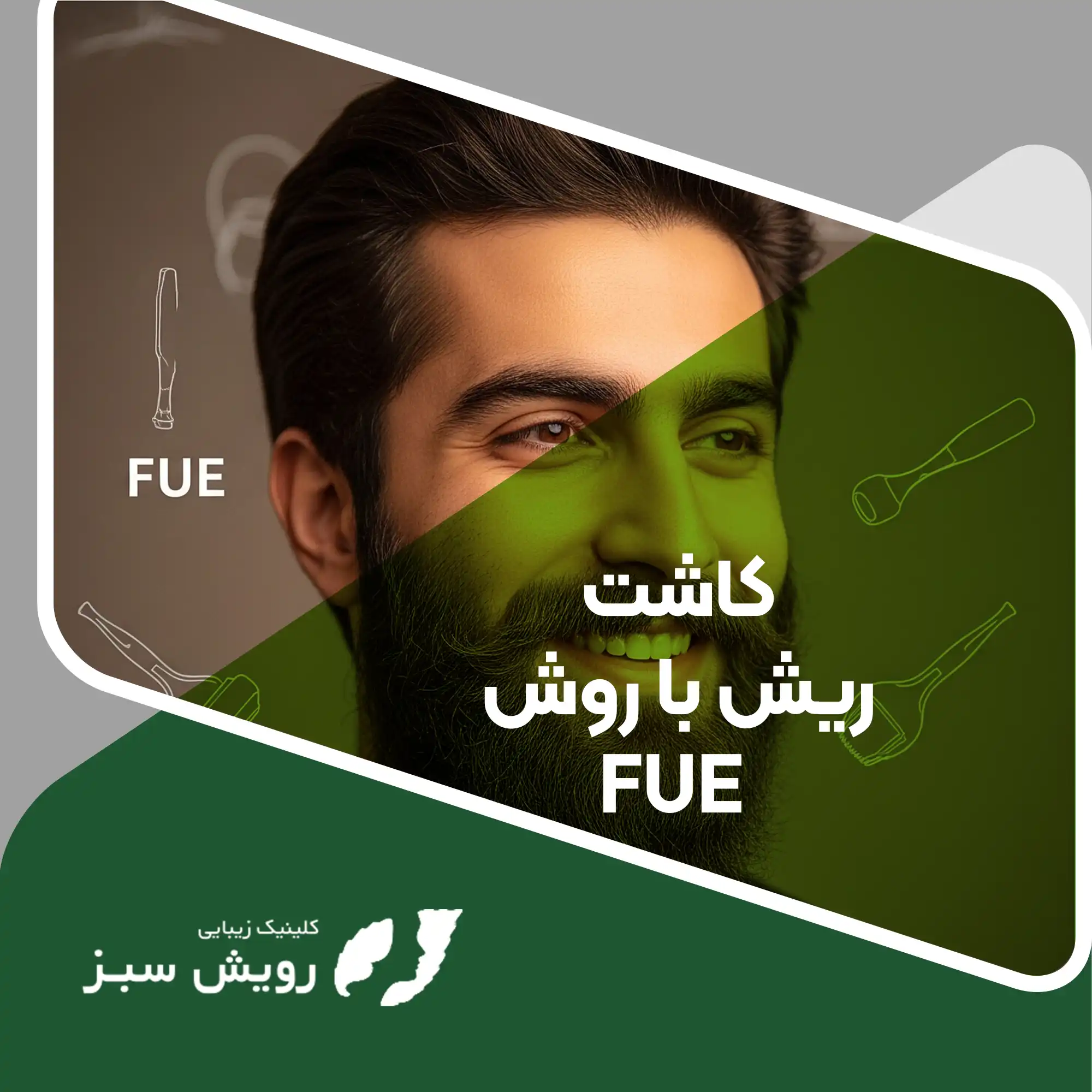 Read more about the article طراحی و کاشت ریش به رویش FUE پرپشت برای مردان جوان: نکات زیبایی‌شناختی در کاشت ریش با روش FUE پیشرفته