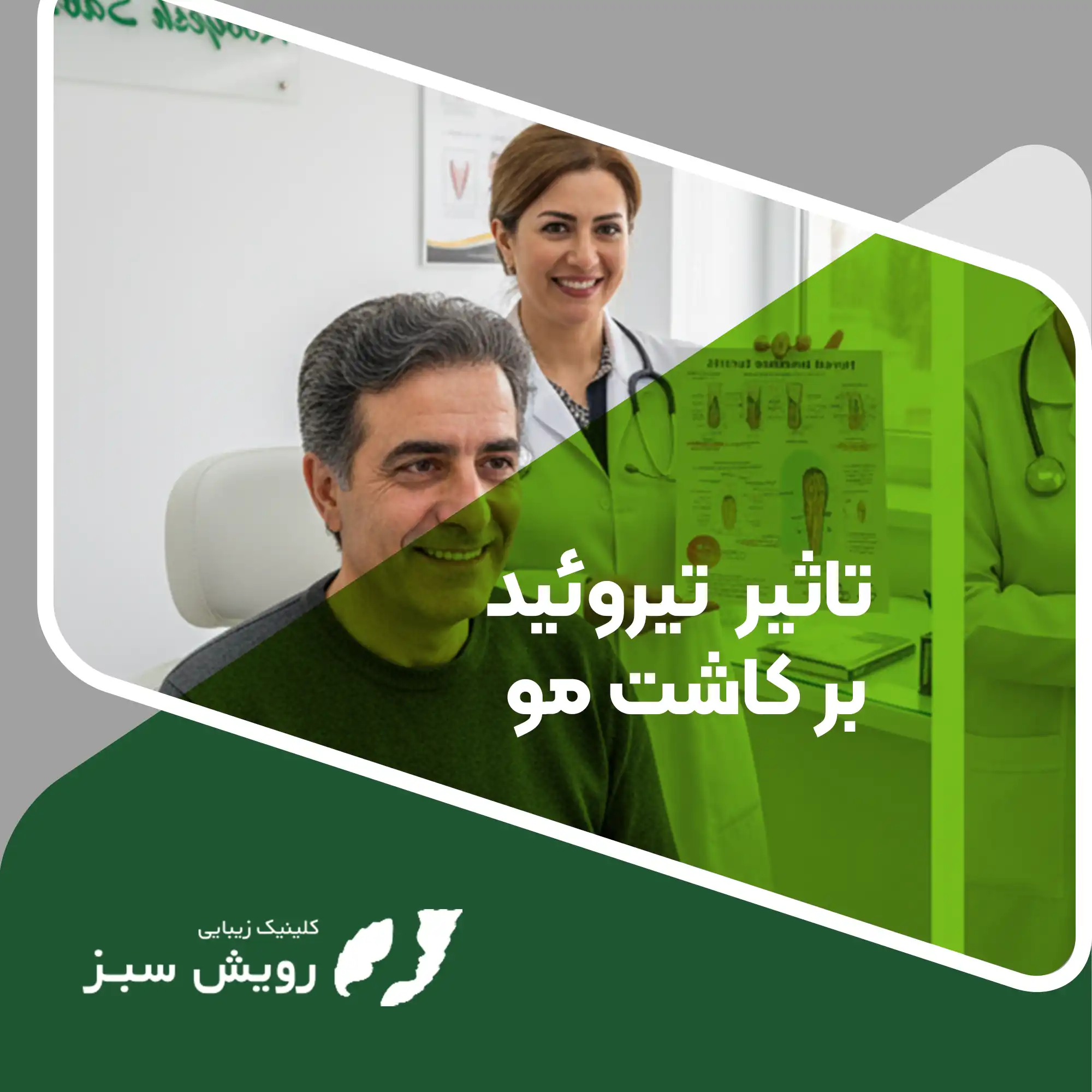 Read more about the article تاثیر بیماری‌های تیروئید بر کاشت مو