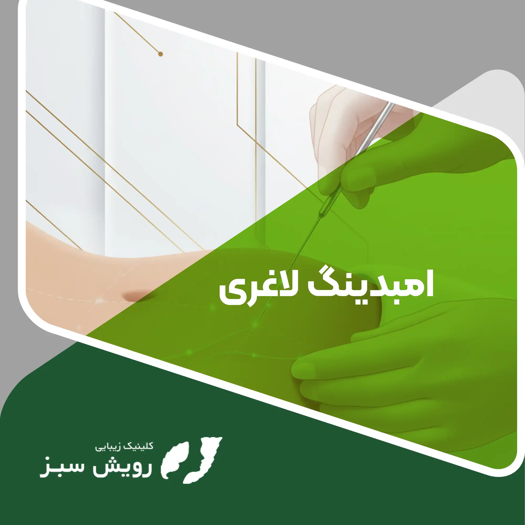 Read more about the article امبدینگ لاغری چیست و چگونه به کاهش وزن کمک می‌کند؟ نگاهی علمی و واقعی به این روش پرطرفدار