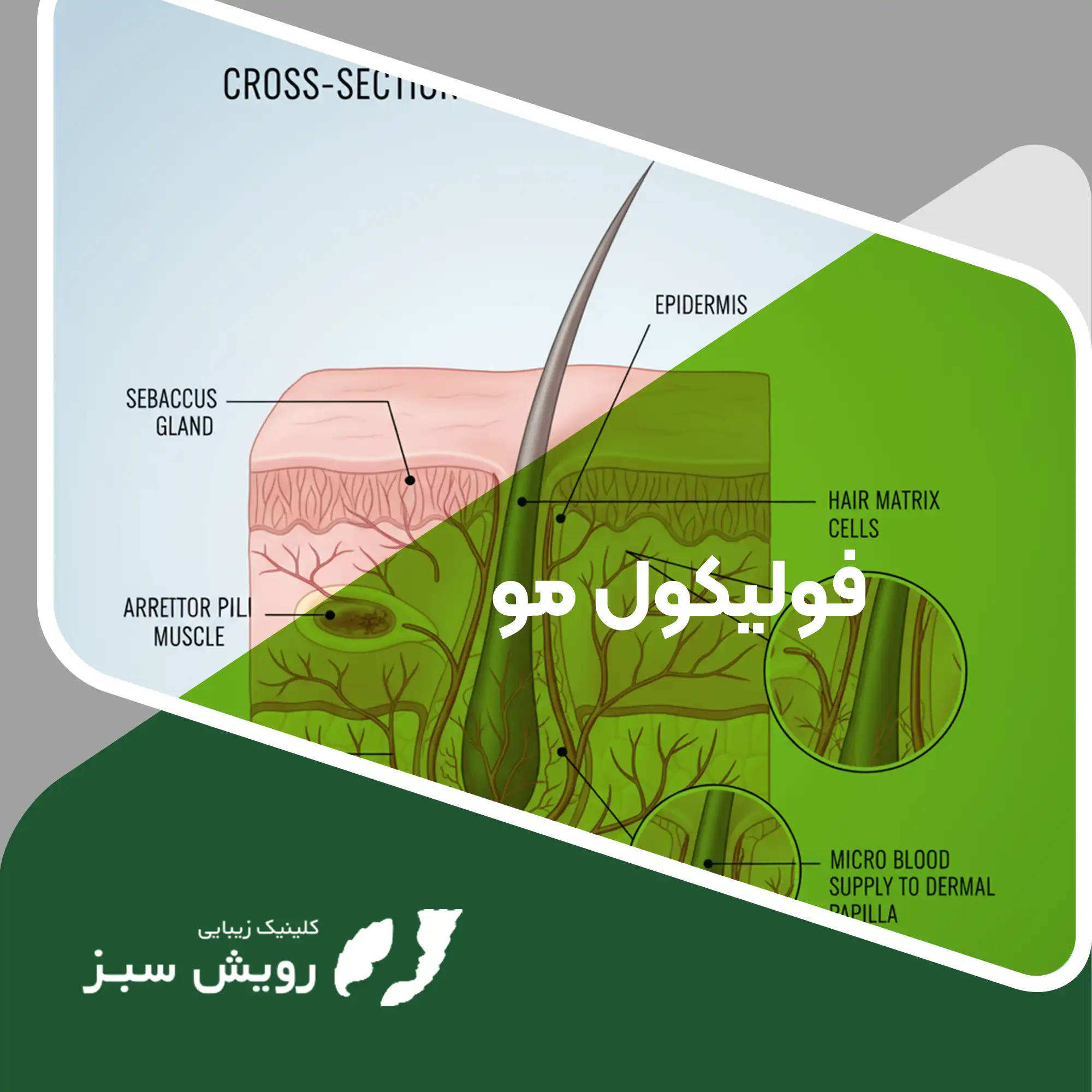 Read more about the article فولیکول مو چیست و چرا در فرایند کاشت مو باید به آن اهمیت داد
