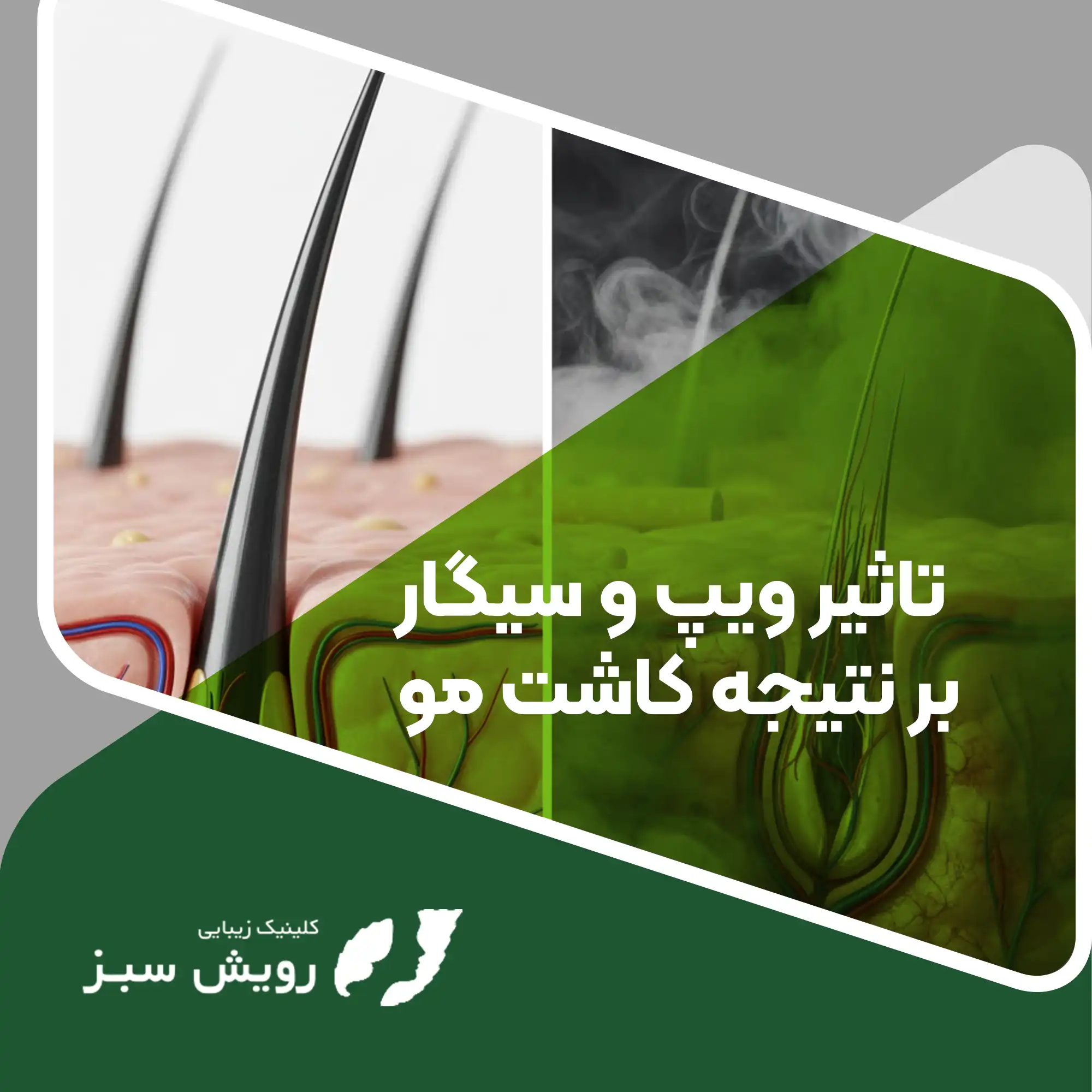 Read more about the article تفاوت تاثیر ویپ و سیگار بر نتیجه کاشت مو؛ انتخابی میان بد و بدتر