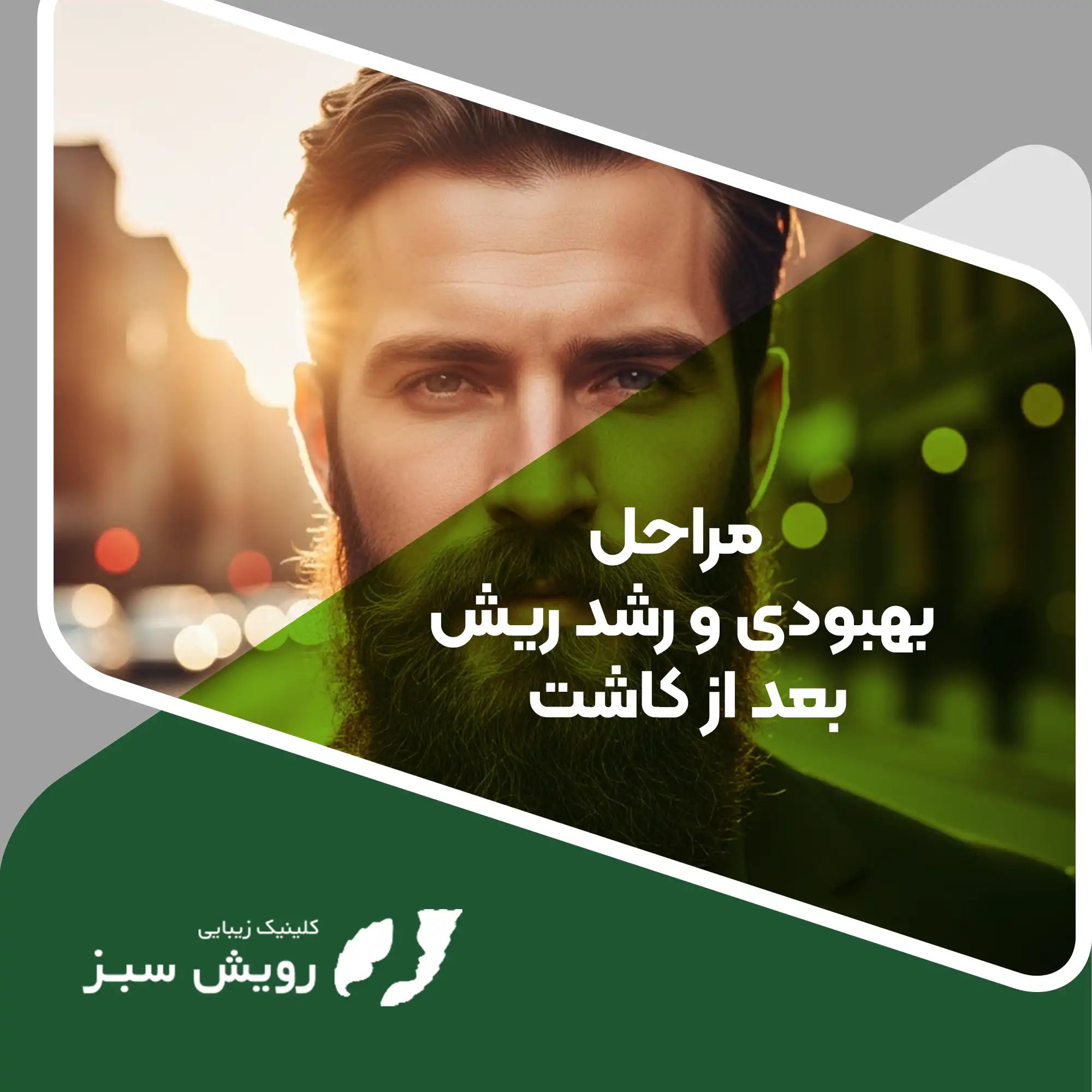 Read more about the article مراحل بهبودی و رشد ریش بعد از کاشت؛ سفری علمی از التهاب تا جذابیت