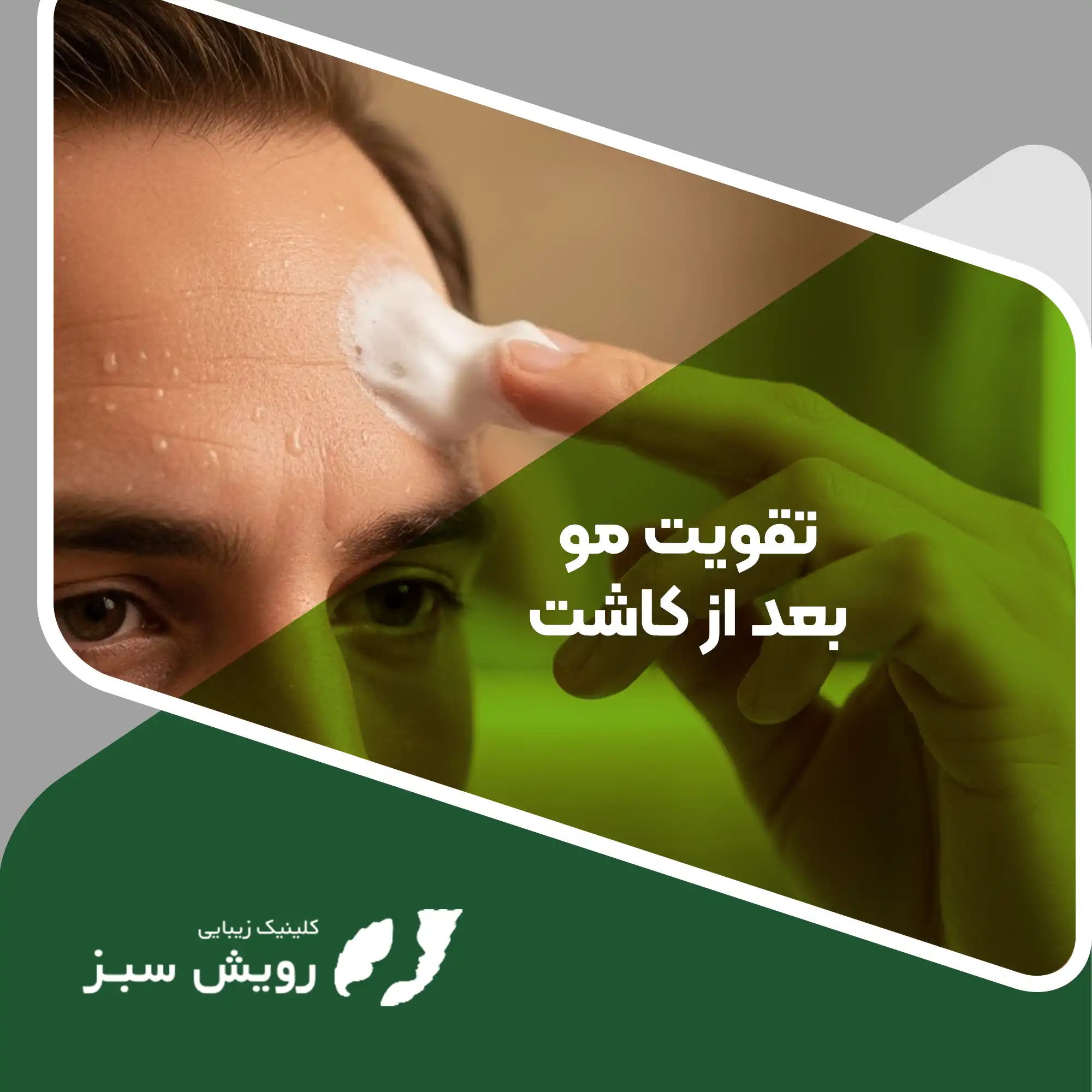 Read more about the article ۱۲ روش موثر برای تقویت مو بعد از کاشت؛ عبور از اتاق عمل تا رسیدن به جذابیت
