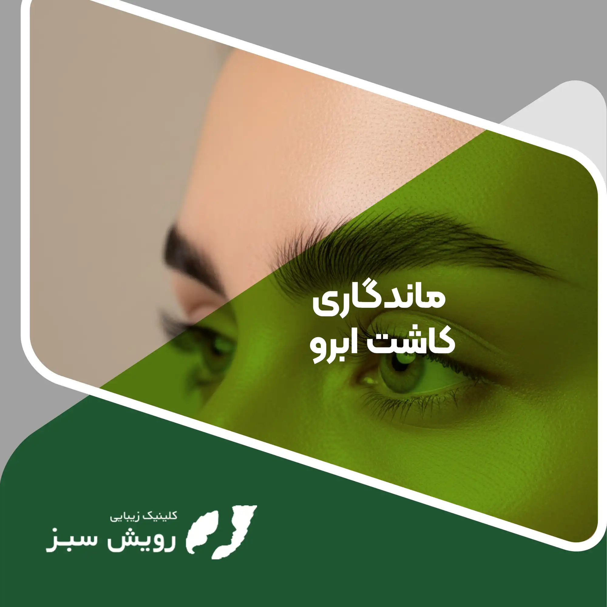 Read more about the article ماندگاری کاشت ابرو؛ سرمایه‌گذاری مادام‌العمر بر روی زیبایی چهره