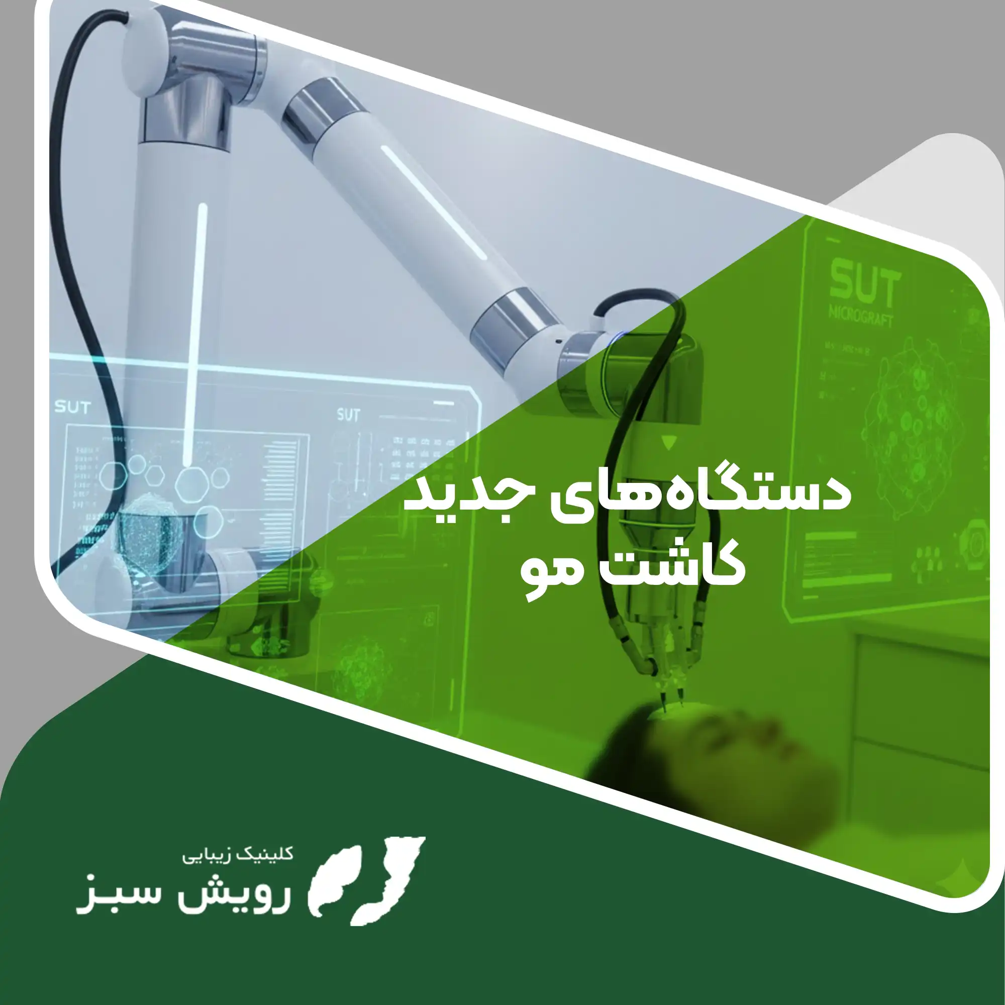 Read more about the article نبرد تکنولوژی و بازاریابی؛ حقیقتِ دستگاه‌های جدید کاشت مو در سال ۲۰۲۵