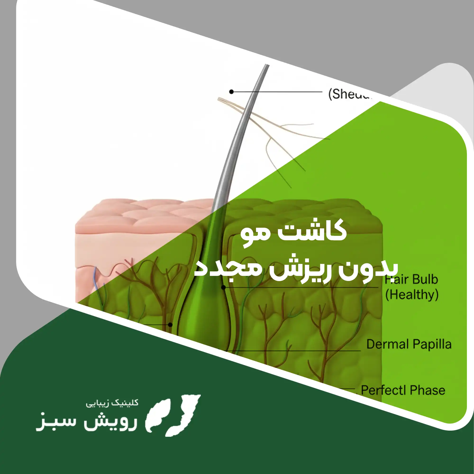 Read more about the article کاشت مو بدون ریزش مجدد و مرز باریک بین حقیقت علمی و فریب تبلیغاتی