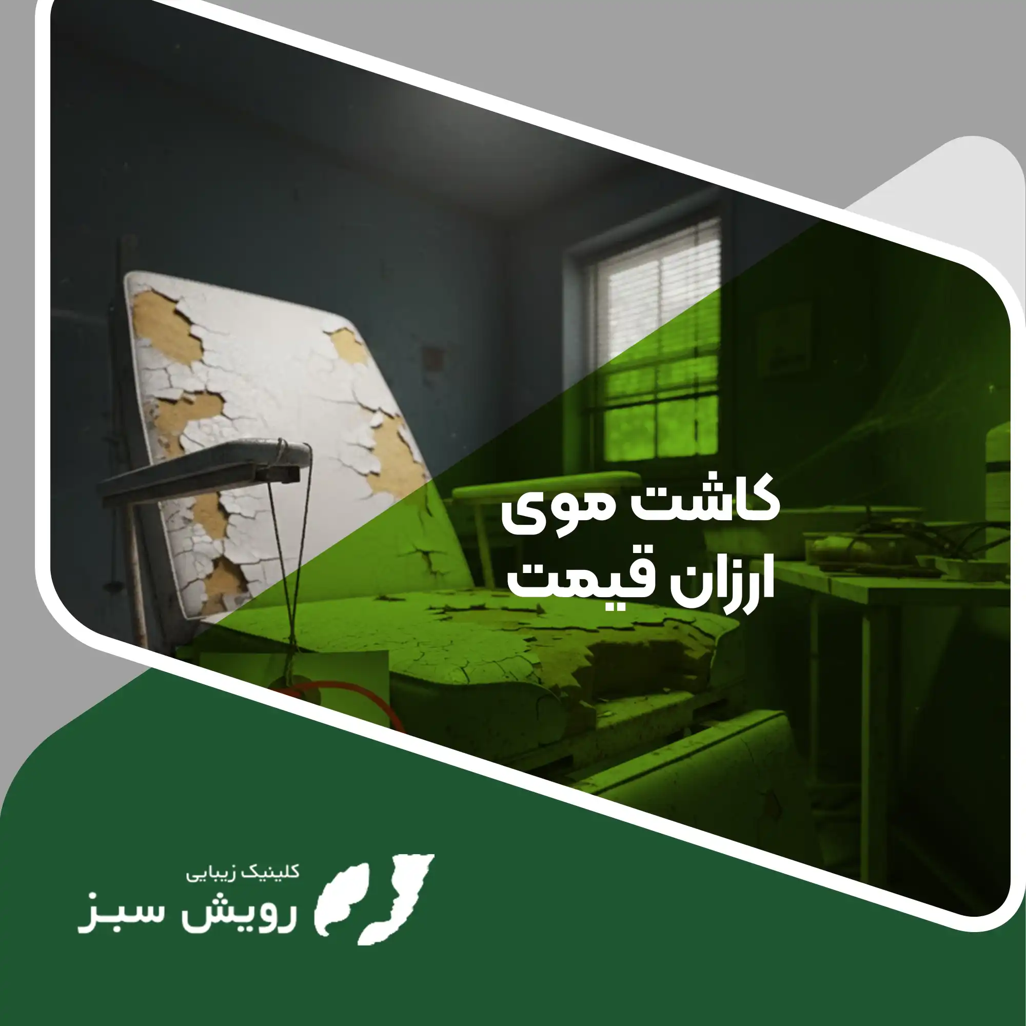 Read more about the article کالبدشکافی کاشت مو ارزان | ارزانی به قیمت جان و زیبایی!