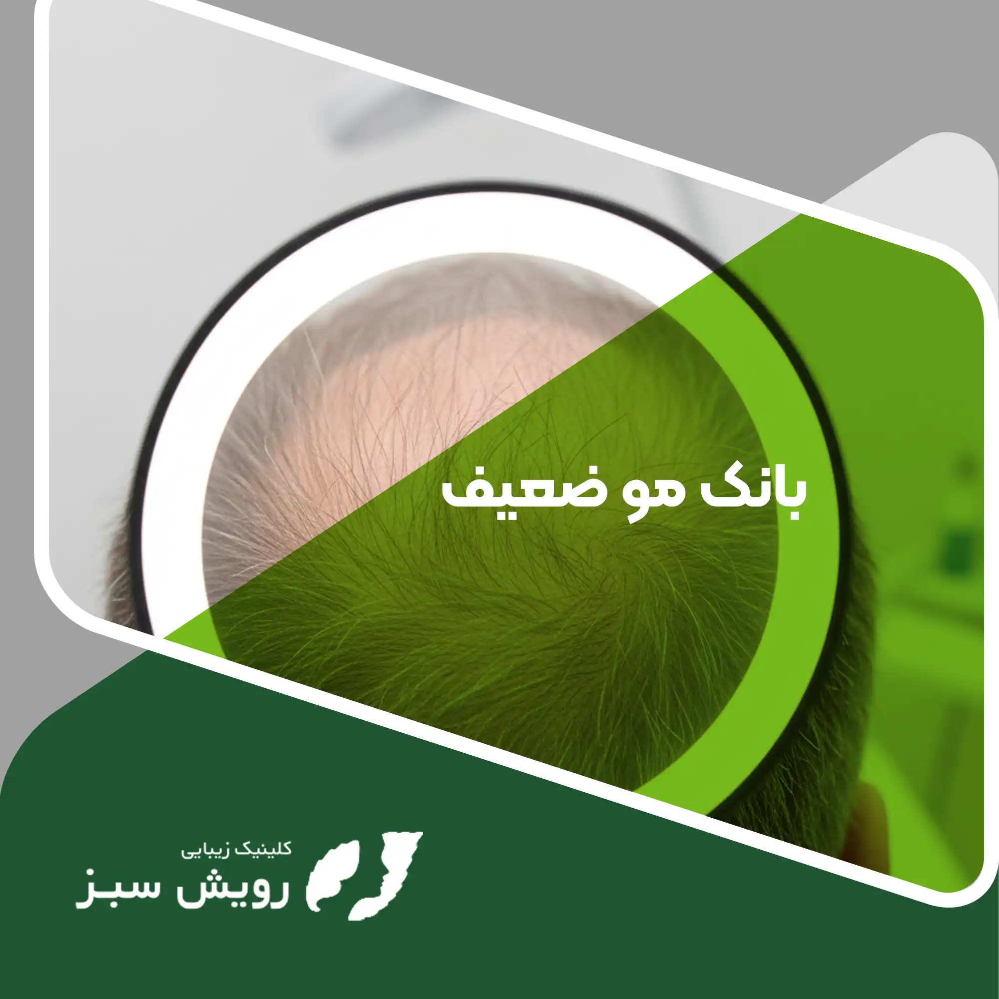 Read more about the article رویای پرپشتی در برابر واقعیت فیزیولوژیک؛ حقیقتِ بانک مو ضعیف