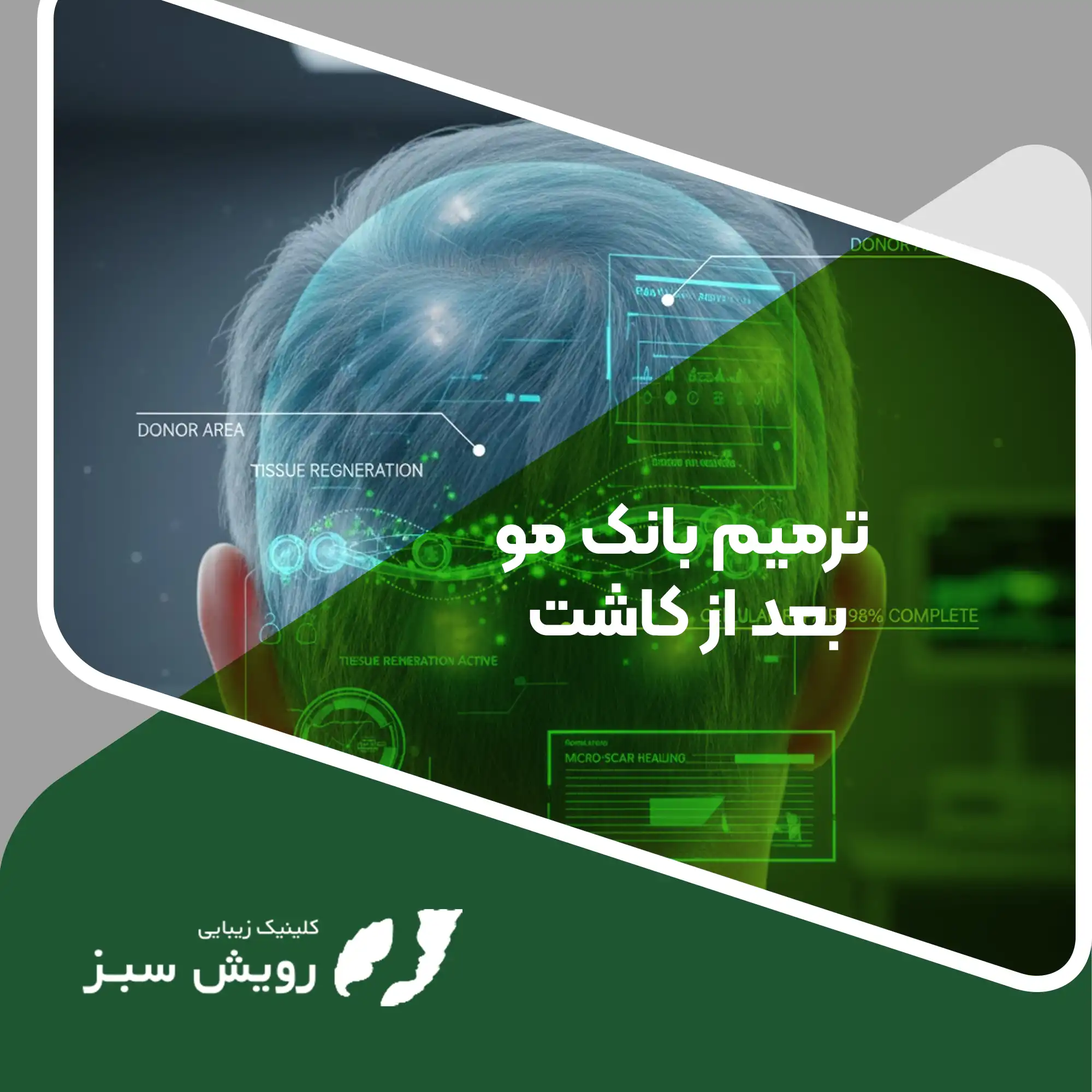 Read more about the article راهکارهای تخصصی ترمیم بانک مو بعد از کاشت