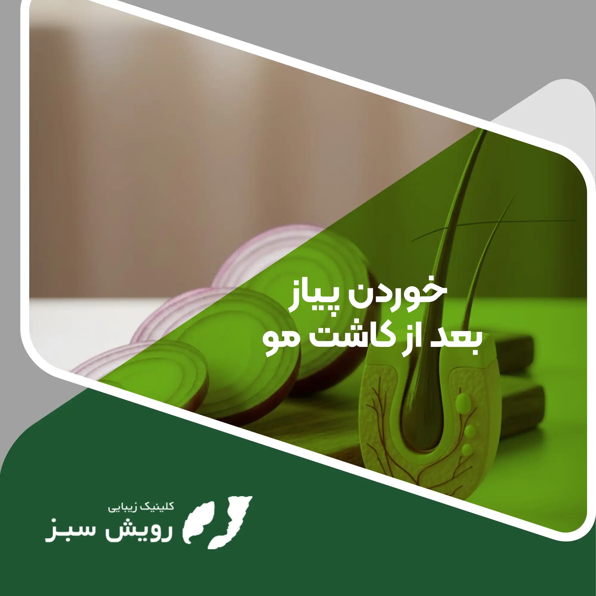Read more about the article تاثیر خوردن پیاز بعد از کاشت مو چیست؟