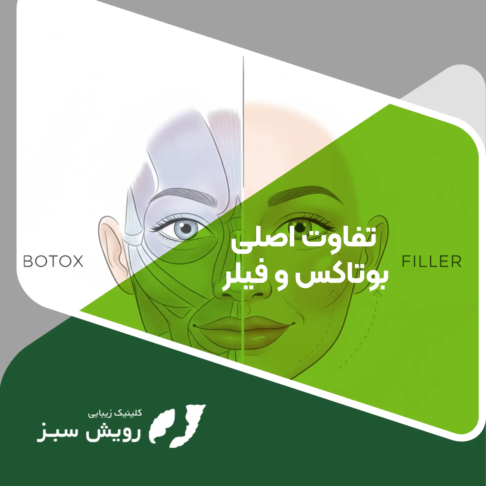 Read more about the article تفاوت بوتاکس و فیلر کدام برای جوان‌سازی پوست بهتر است؟