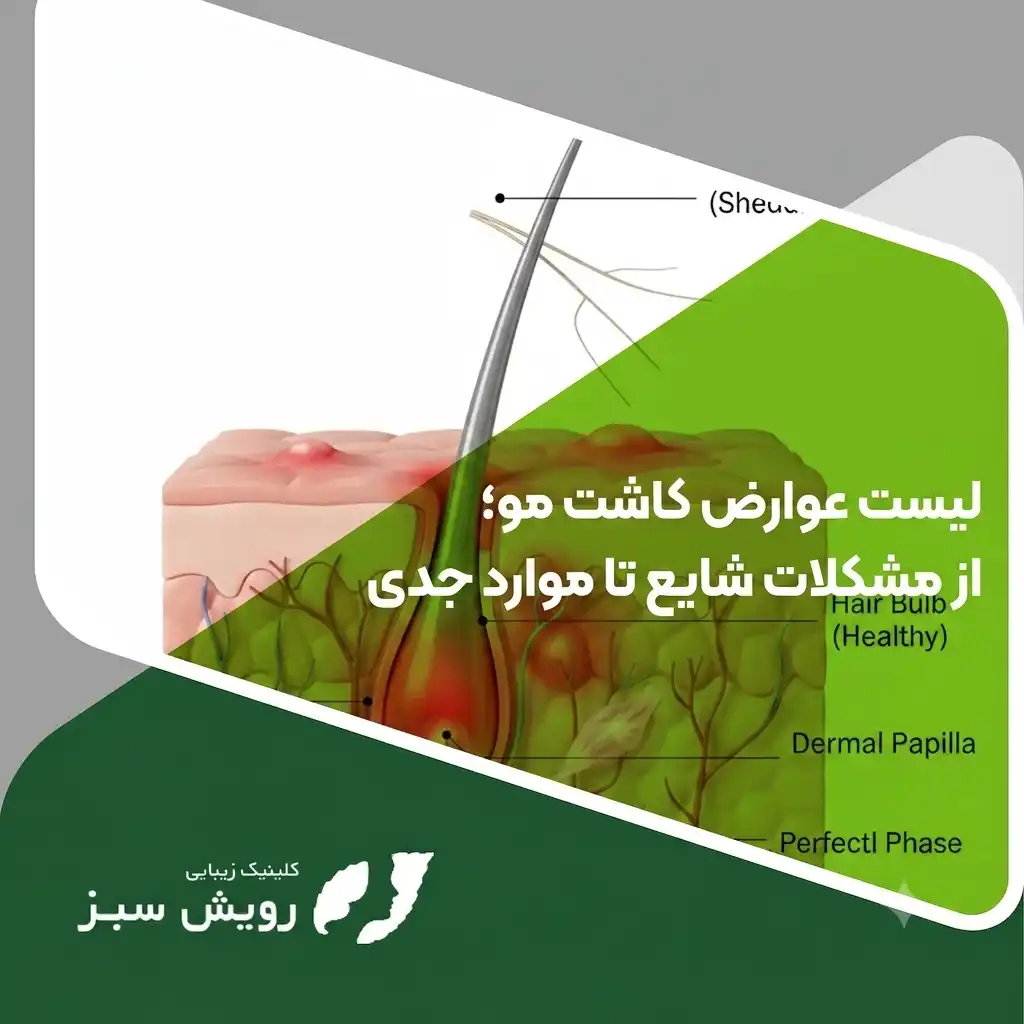 Read more about the article لیست عوارض کاشت مو؛ از مشکلات شایع تا موارد جدی