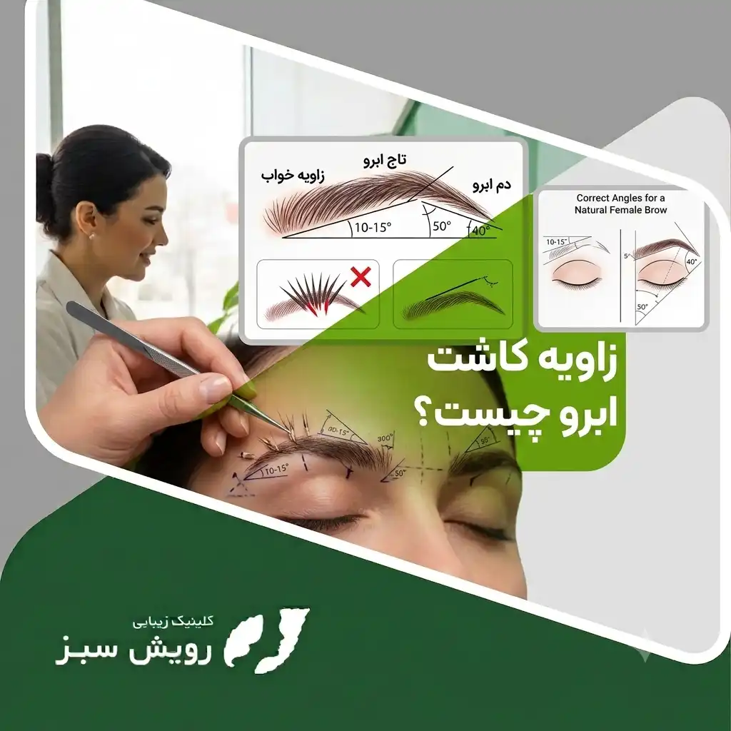Read more about the article زاویه کاشت ابرو چیست؟ نقش آن در طبیعی شدن نتیجه