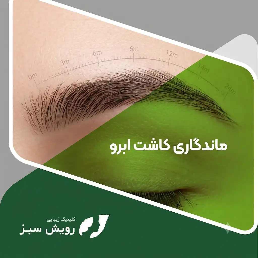 Read more about the article ماندگاری کاشت ابرو چقدر است؟ بررسی علمی دوام نتیجه